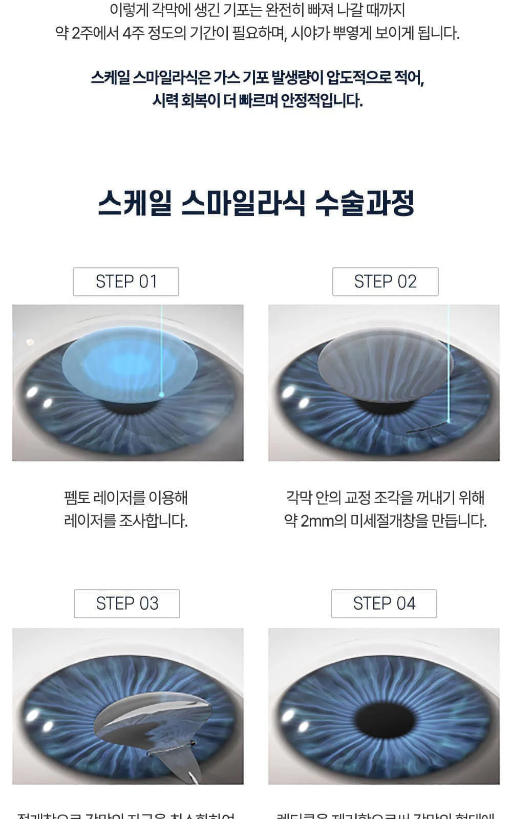 시술 상세 12