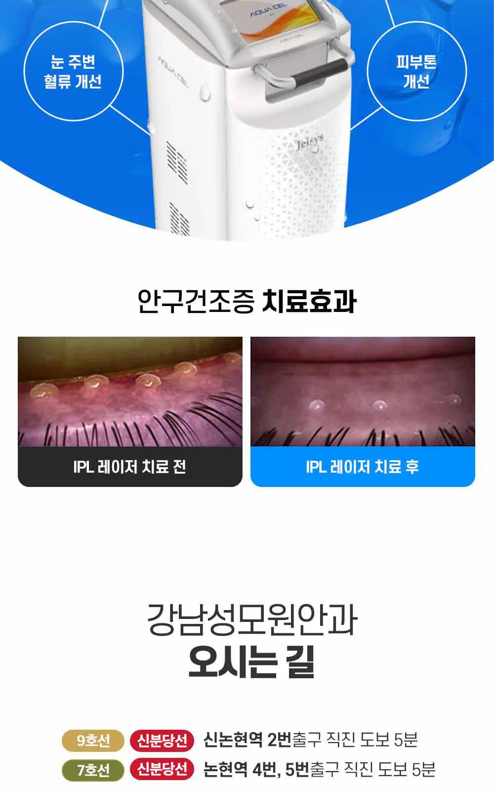 시술 상세 6