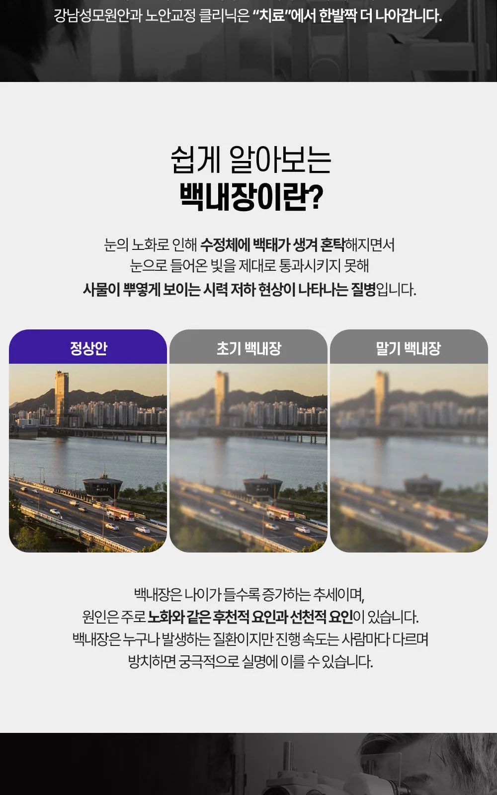 시술 상세 6
