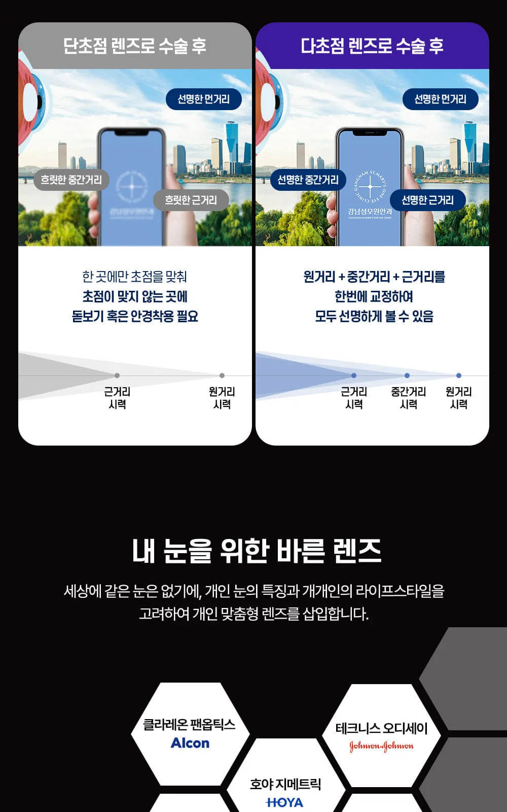 시술 상세 8