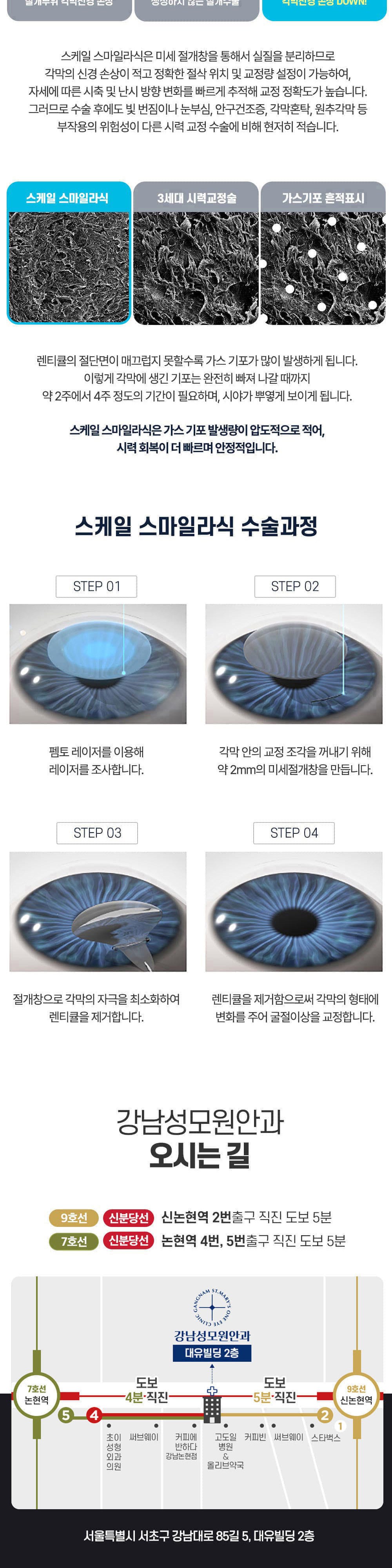 시술 상세 5