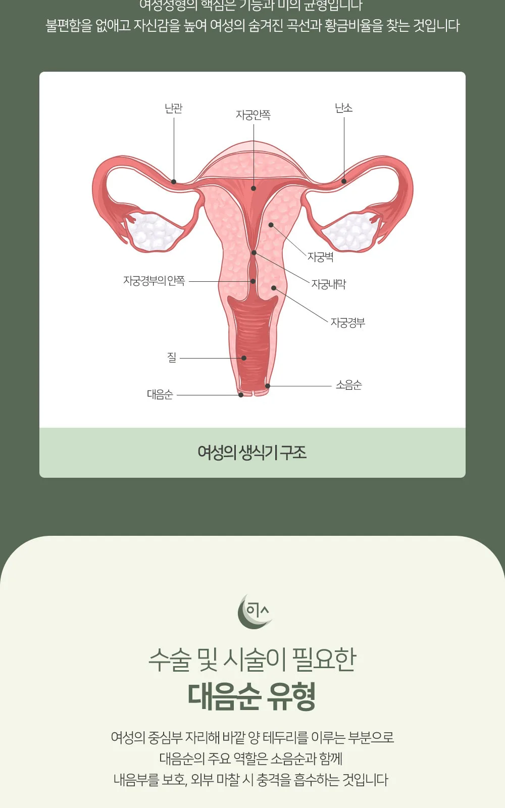 시술 상세 3