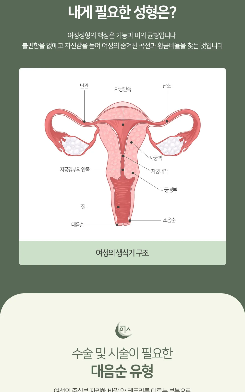 시술 상세 4