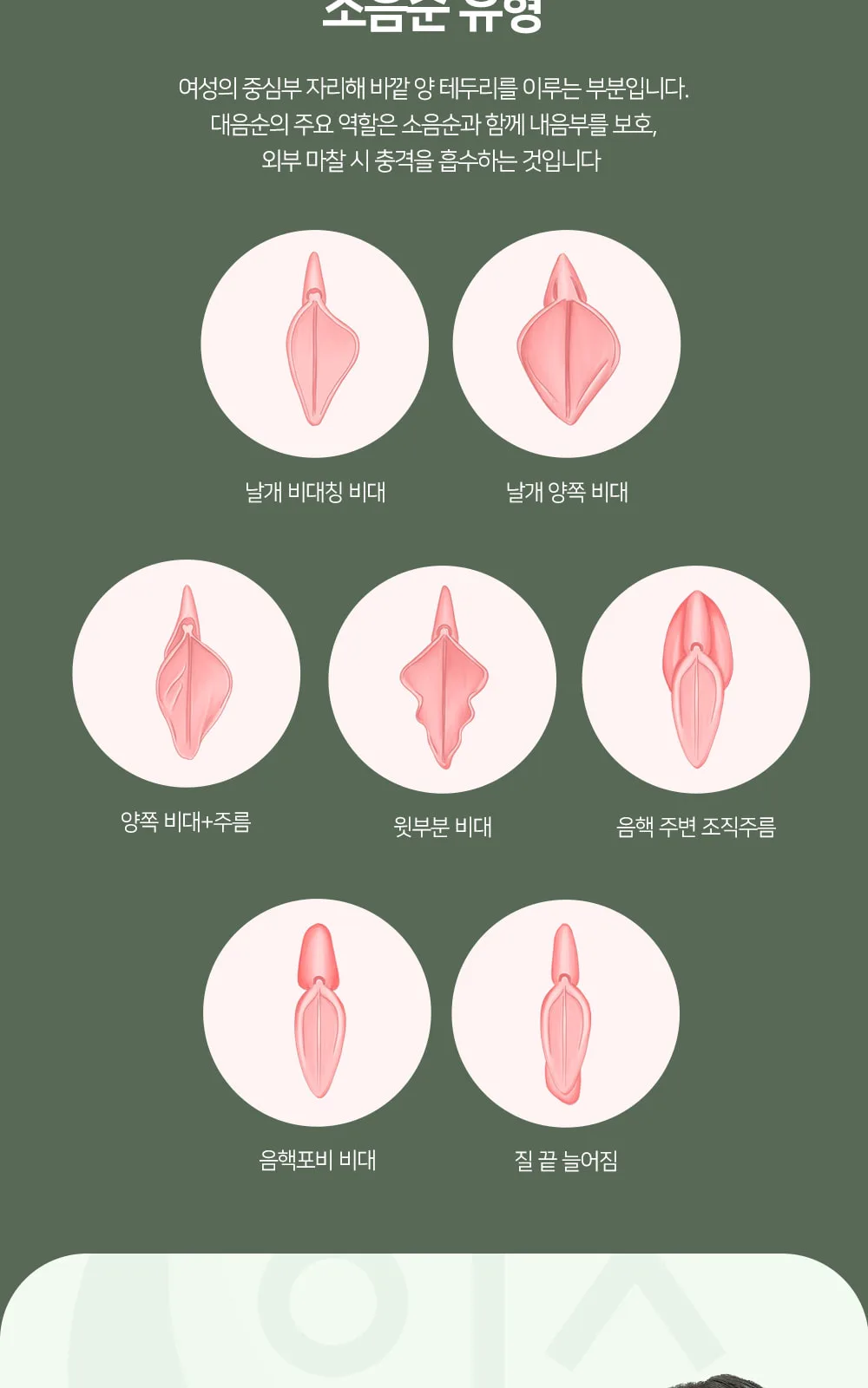 시술 상세 6