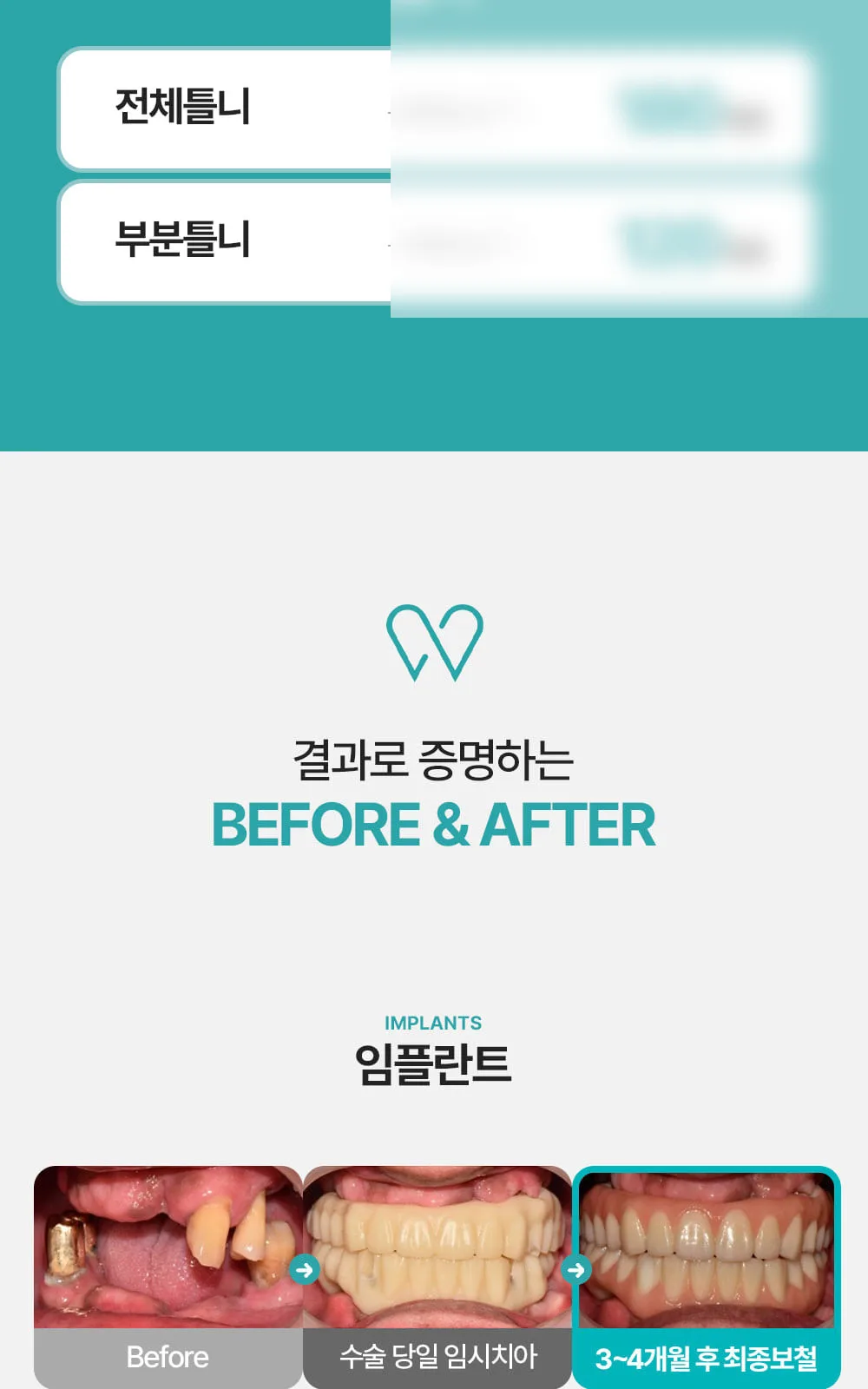 시술 상세 4