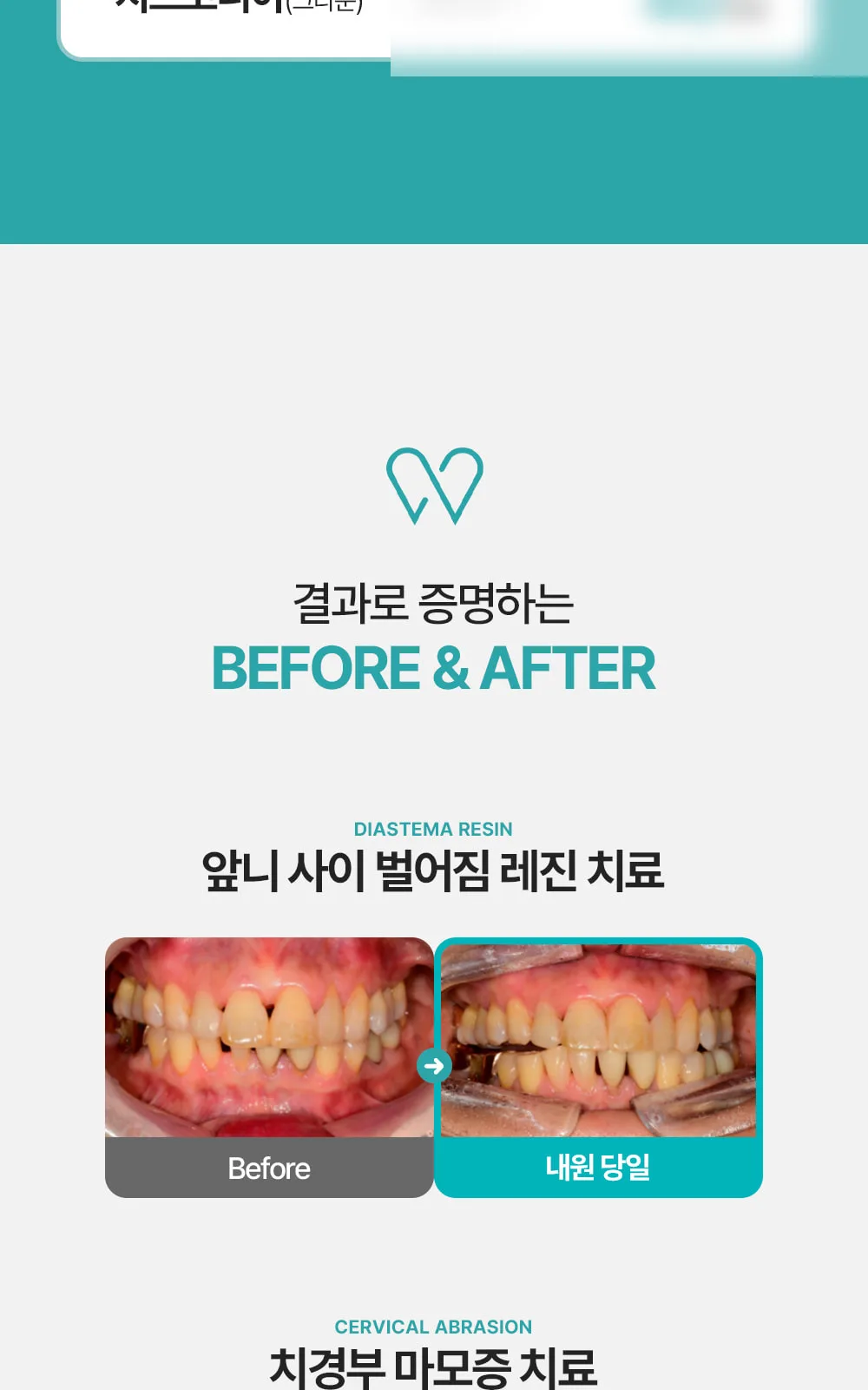 시술 상세 4