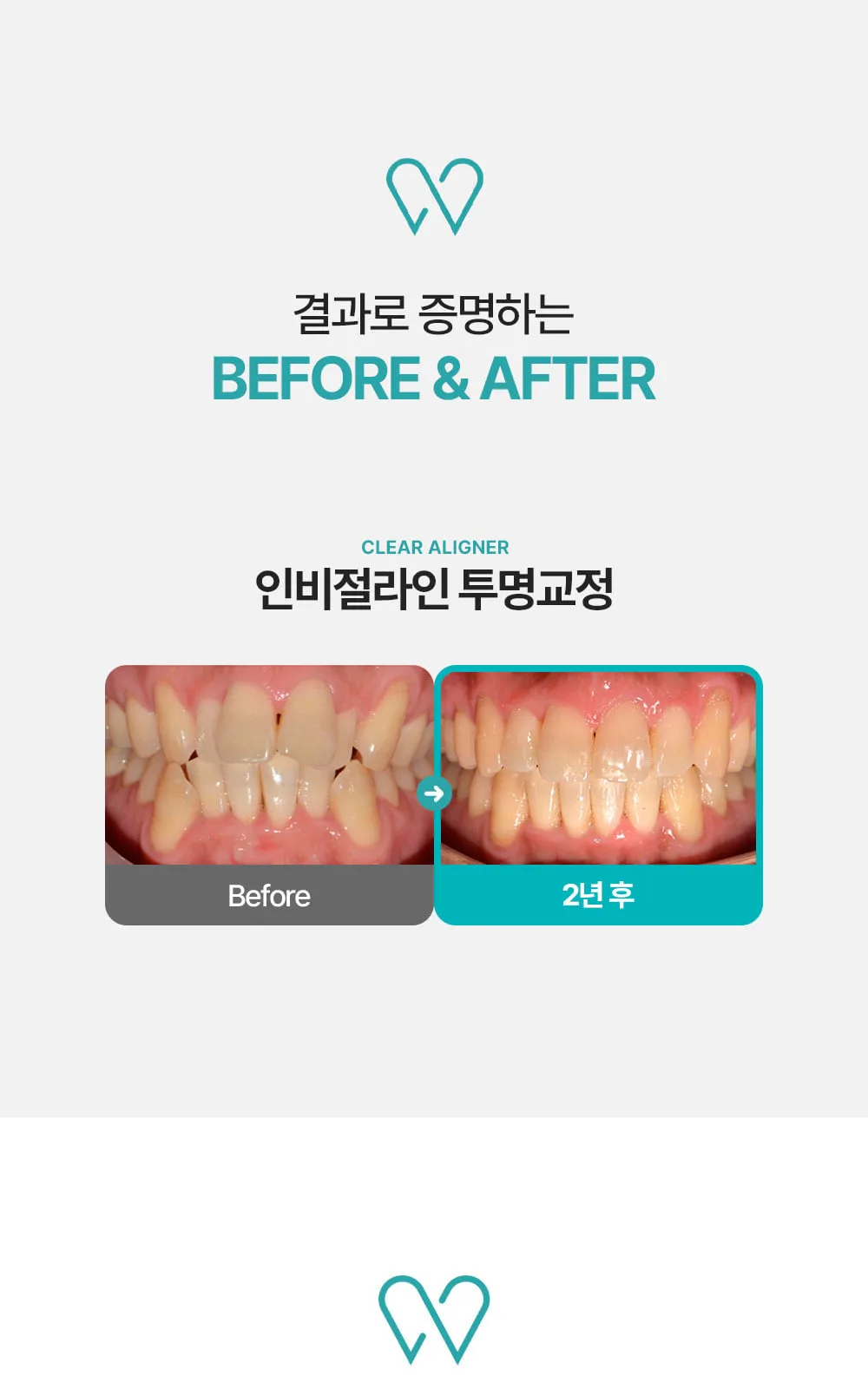 시술 상세 4