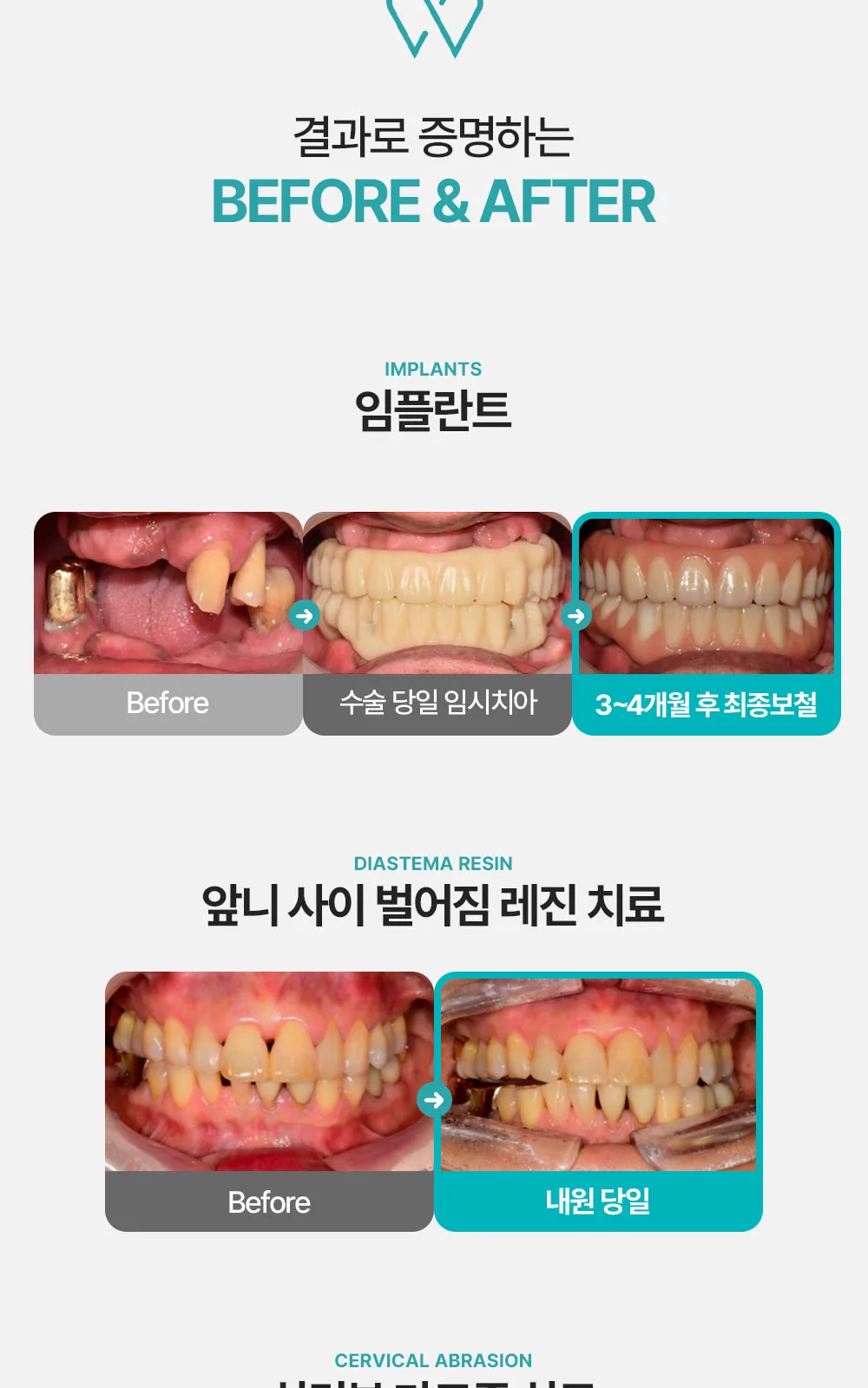 시술 상세 6