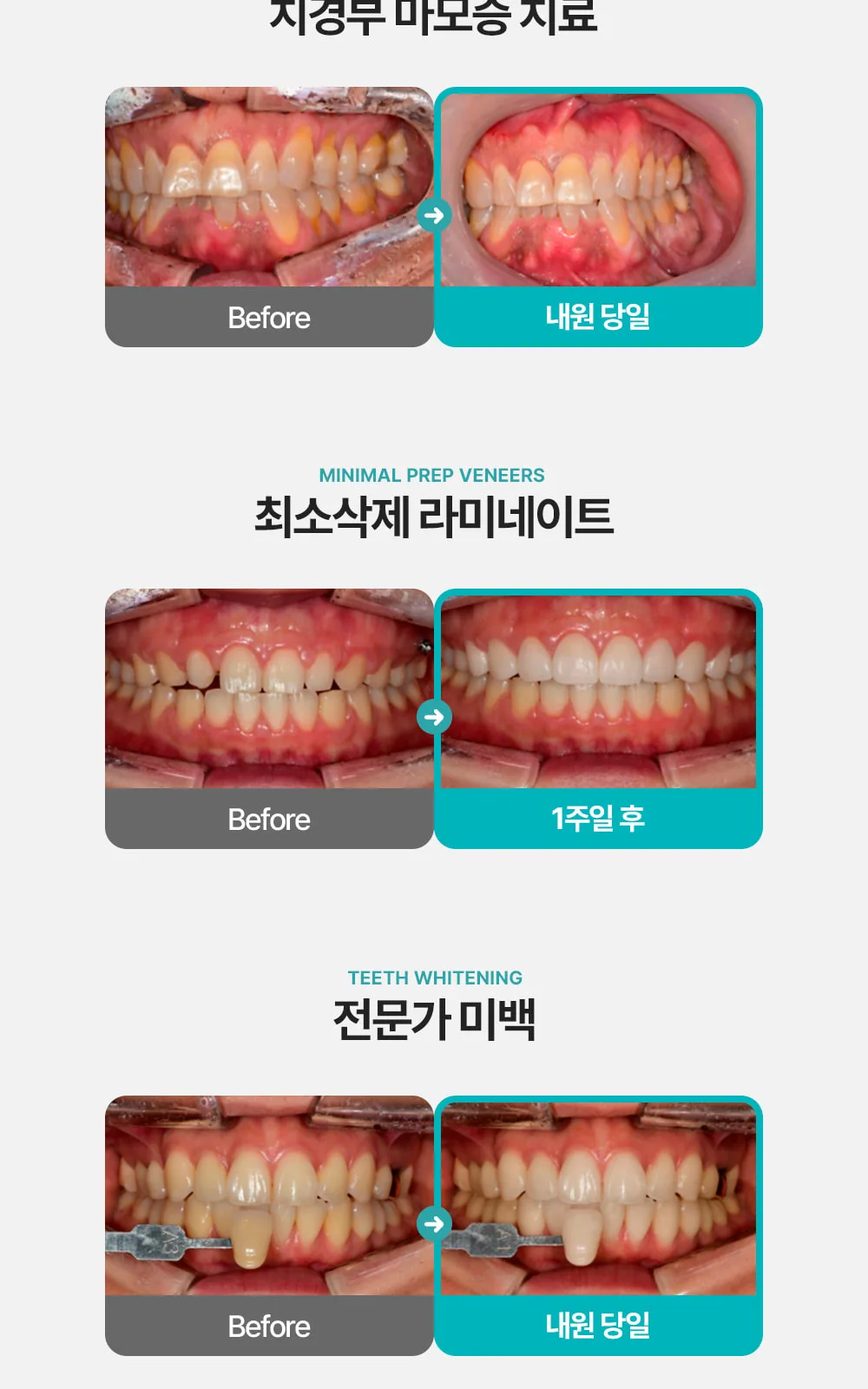 시술 상세 7