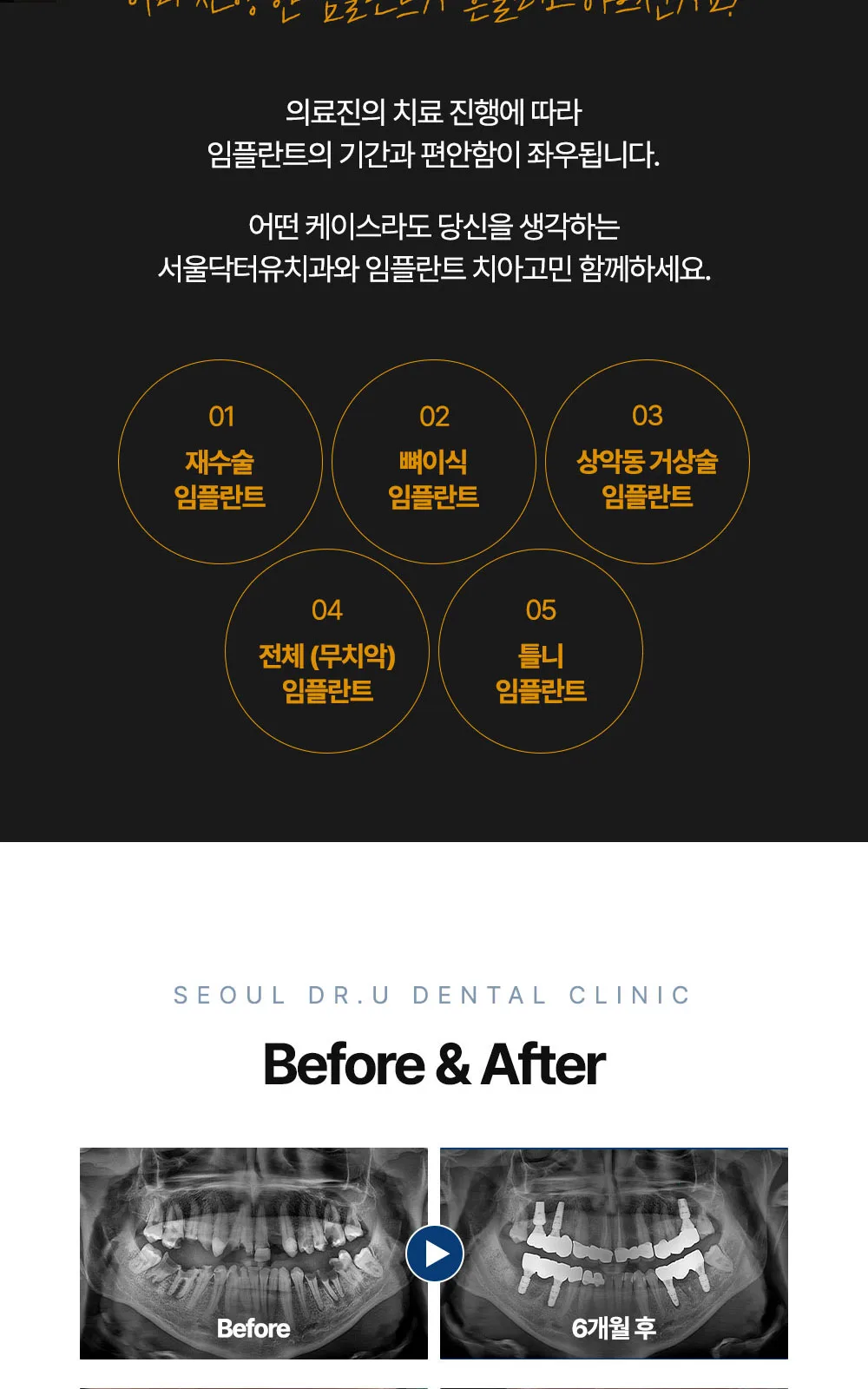 시술 상세 7