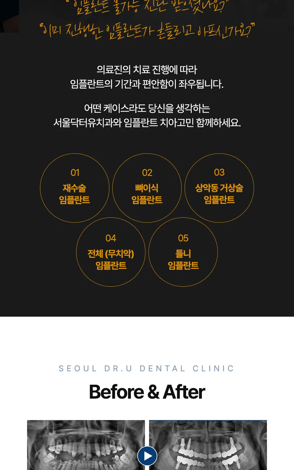 시술 상세 9