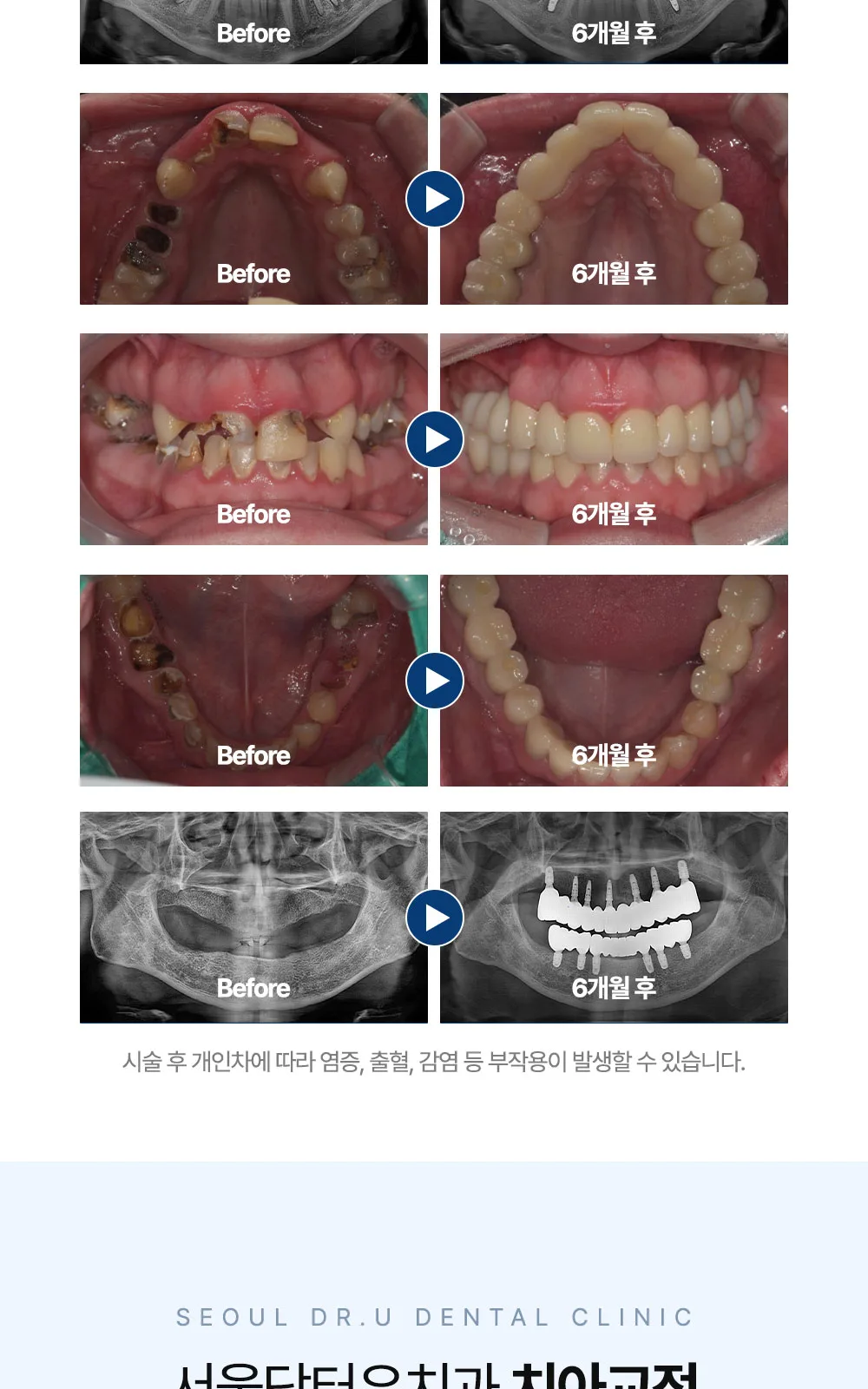 시술 상세 10
