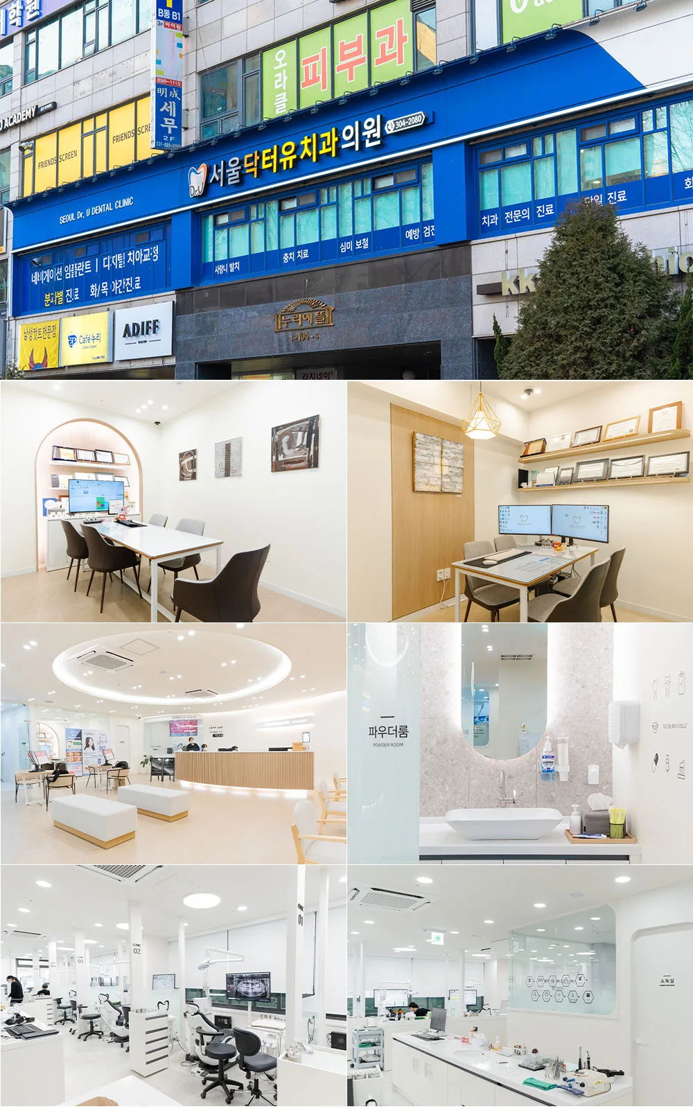 시술 상세 14
