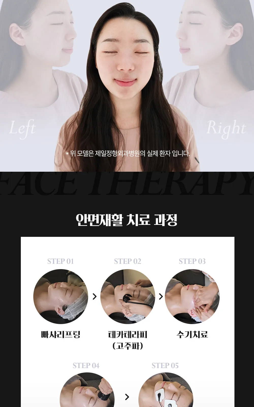 시술 상세 8