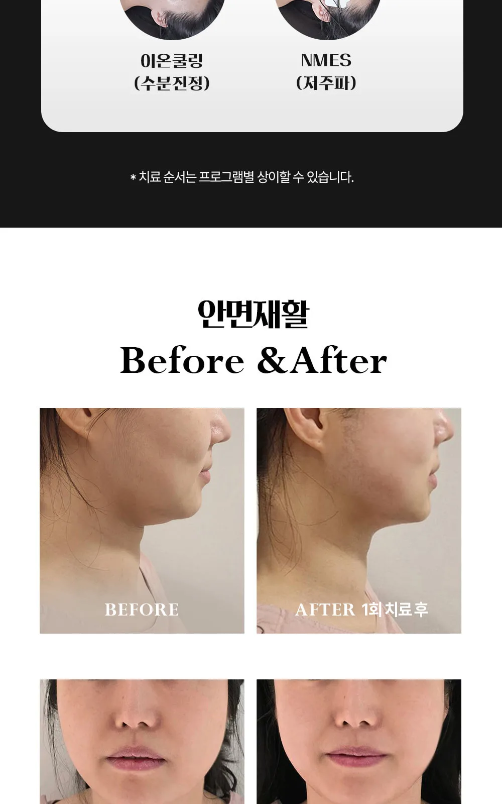 시술 상세 9