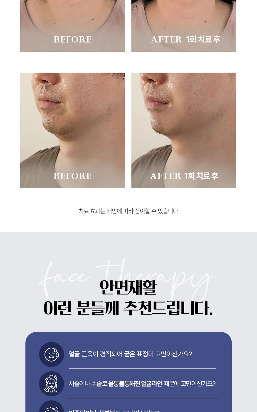 시술 상세 10