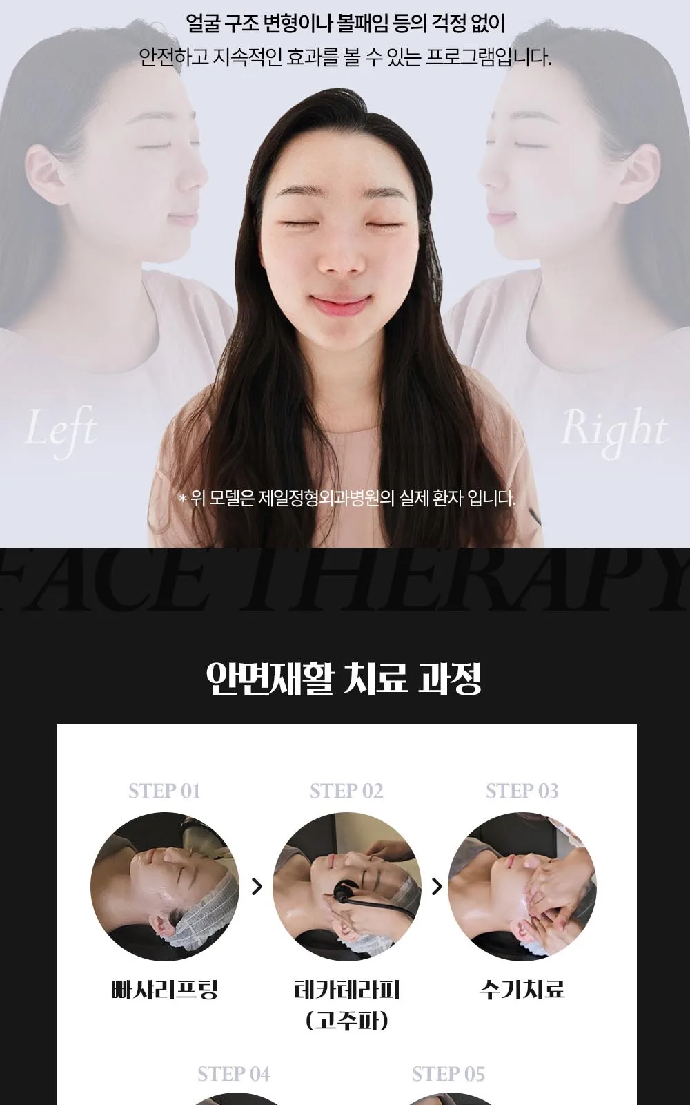 시술 상세 14