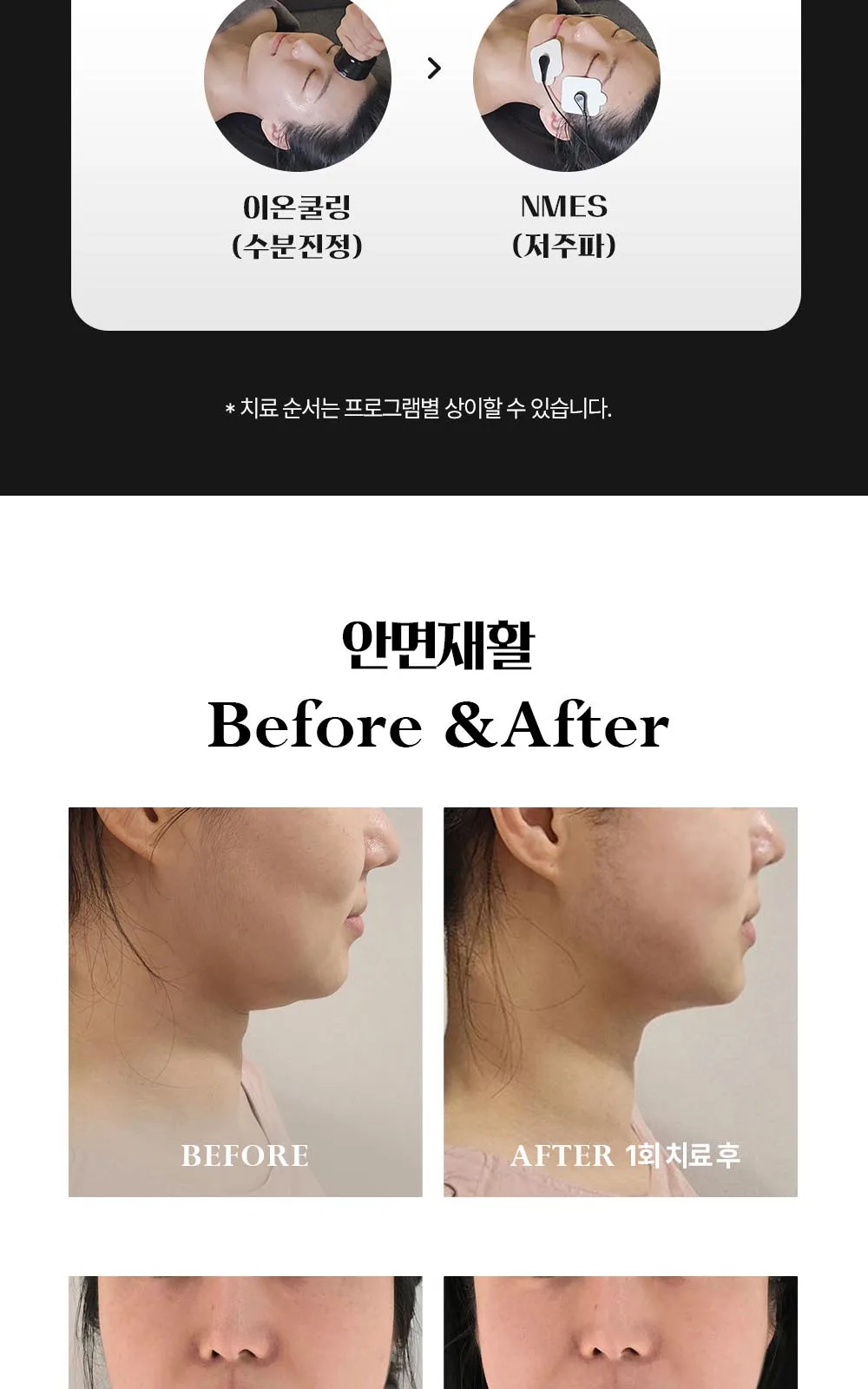 시술 상세 15
