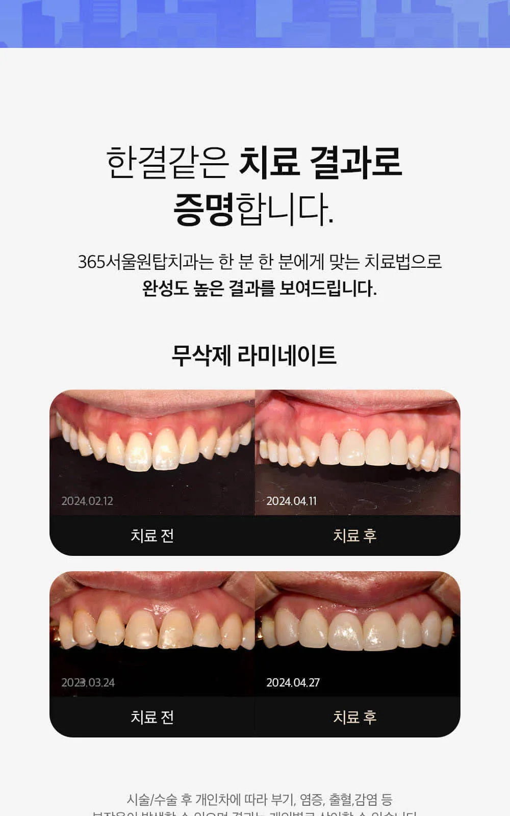 시술 상세 6
