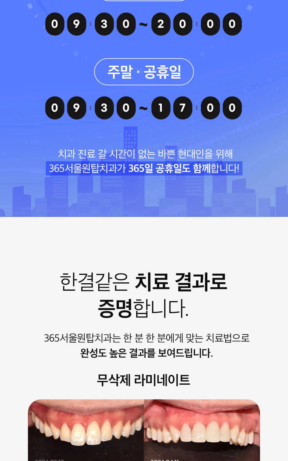시술 상세 6