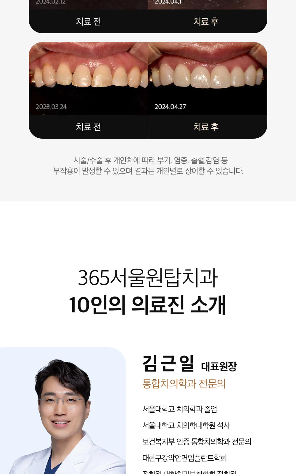 시술 상세 7
