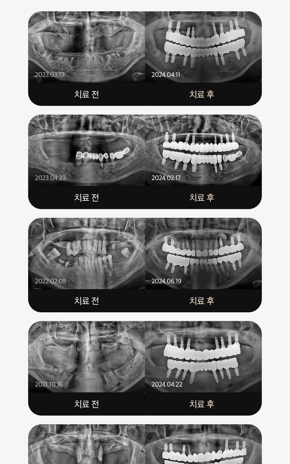 시술 상세 9