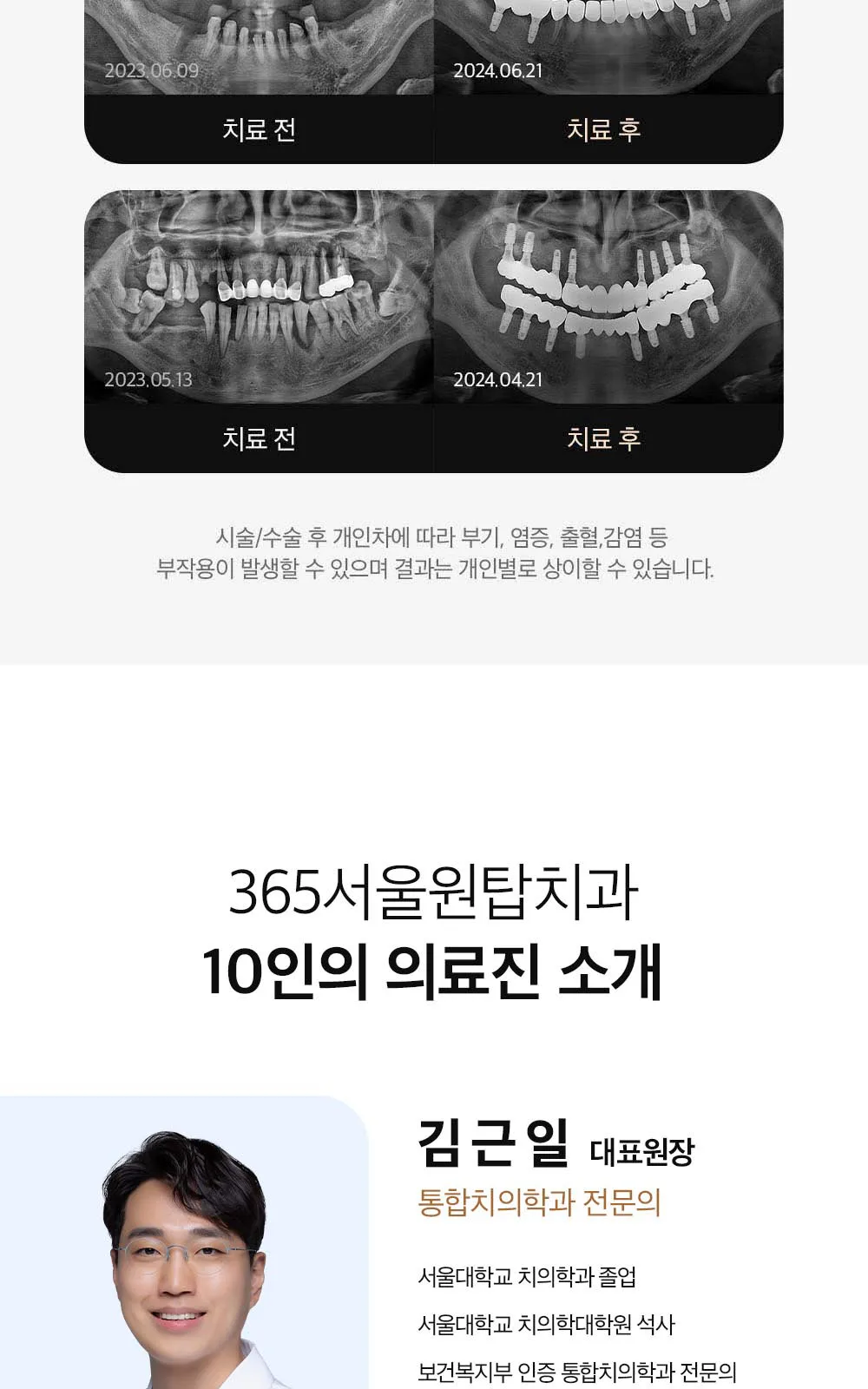 시술 상세 10