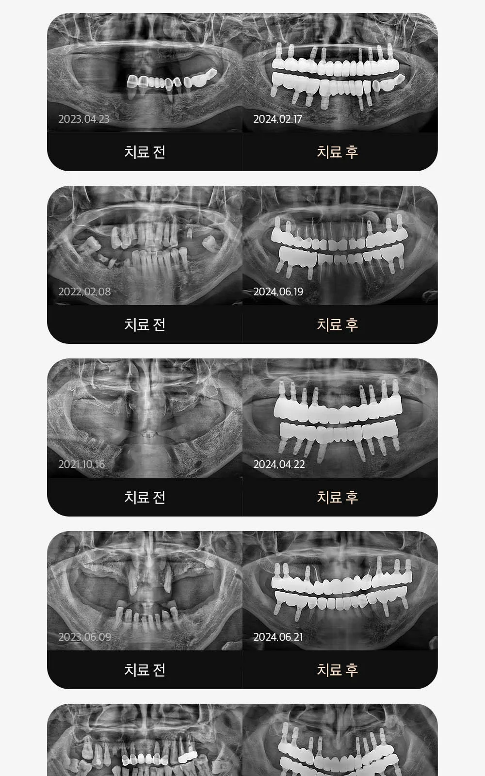 시술 상세 10
