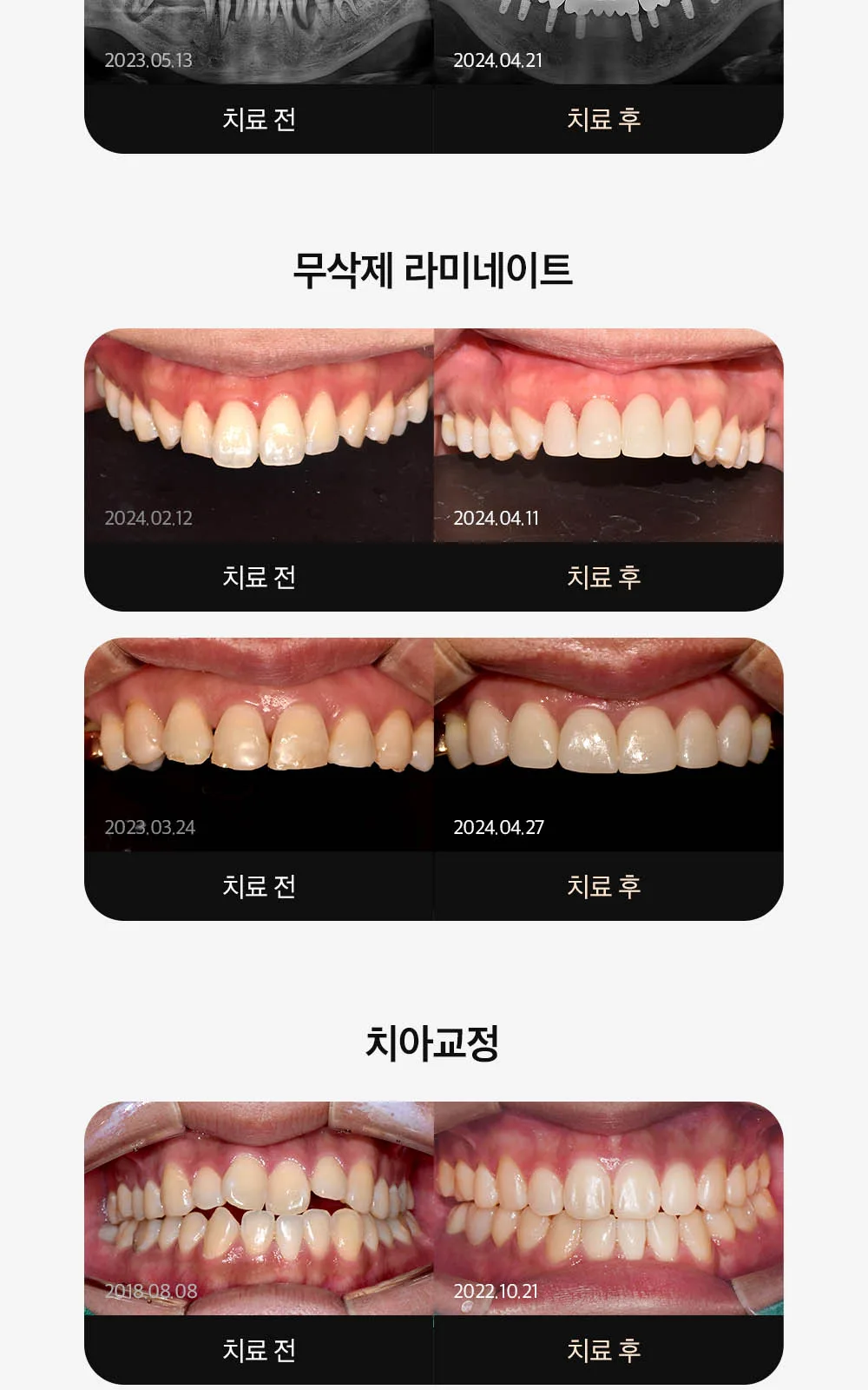 시술 상세 11