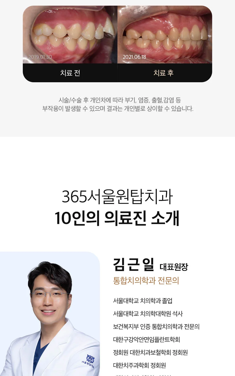 시술 상세 12