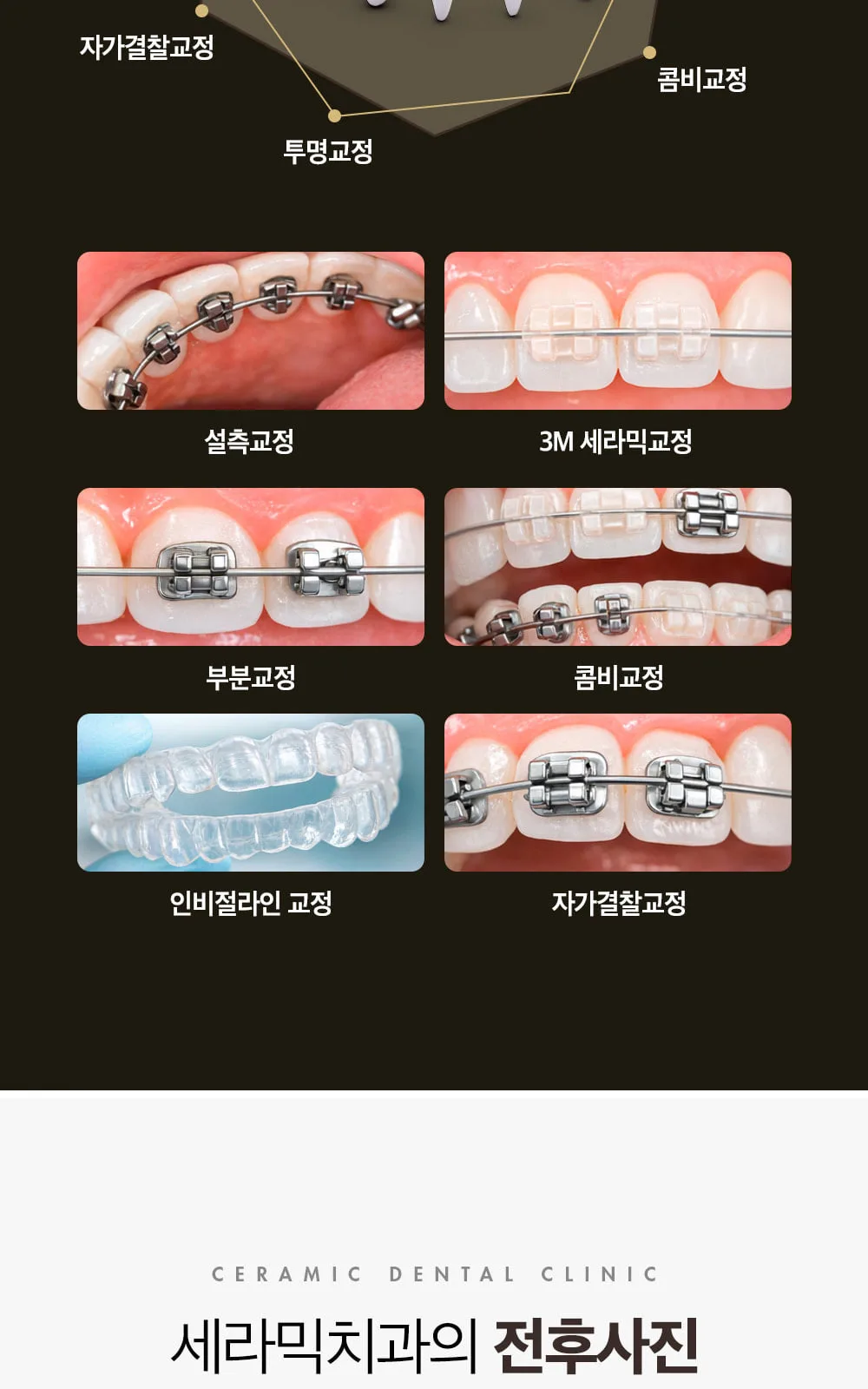 시술 상세 7
