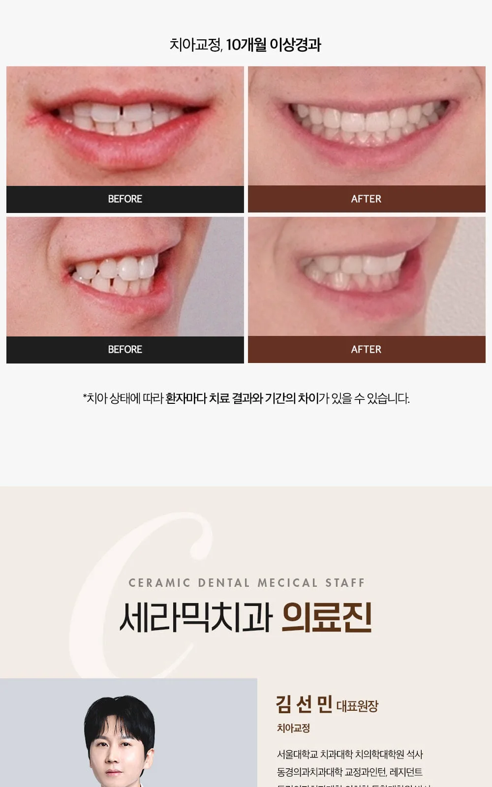 시술 상세 8