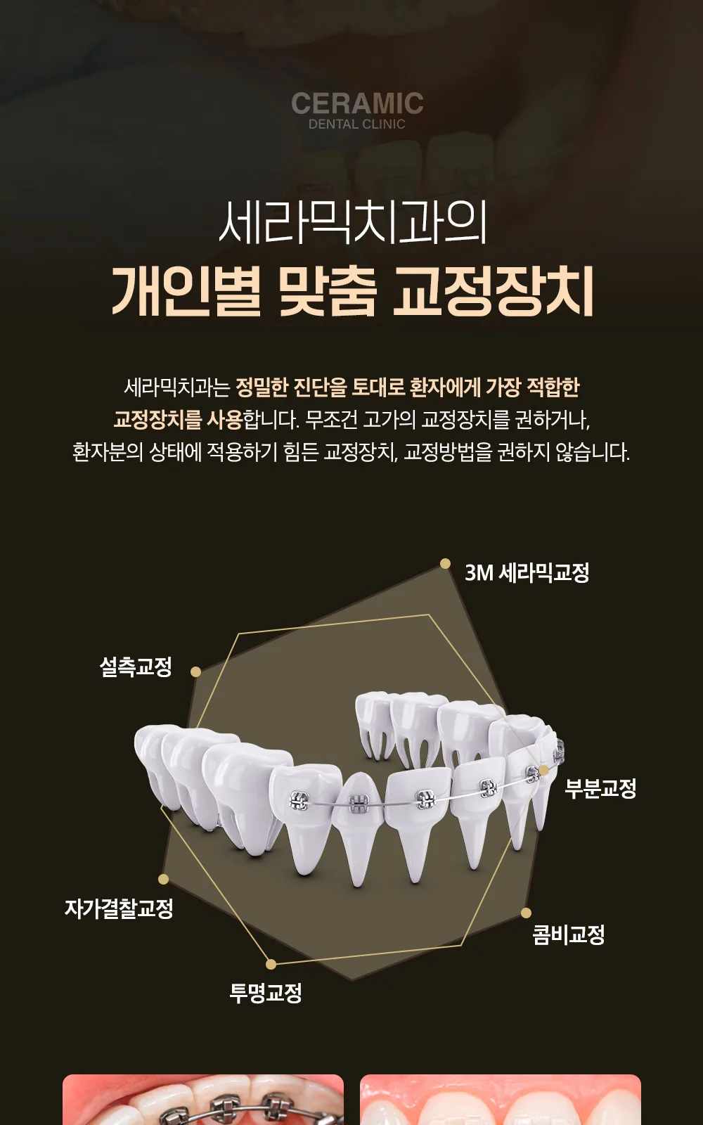 시술 상세 7