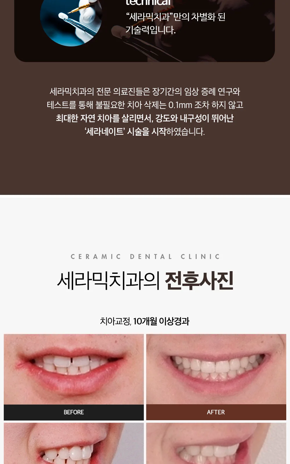 시술 상세 10