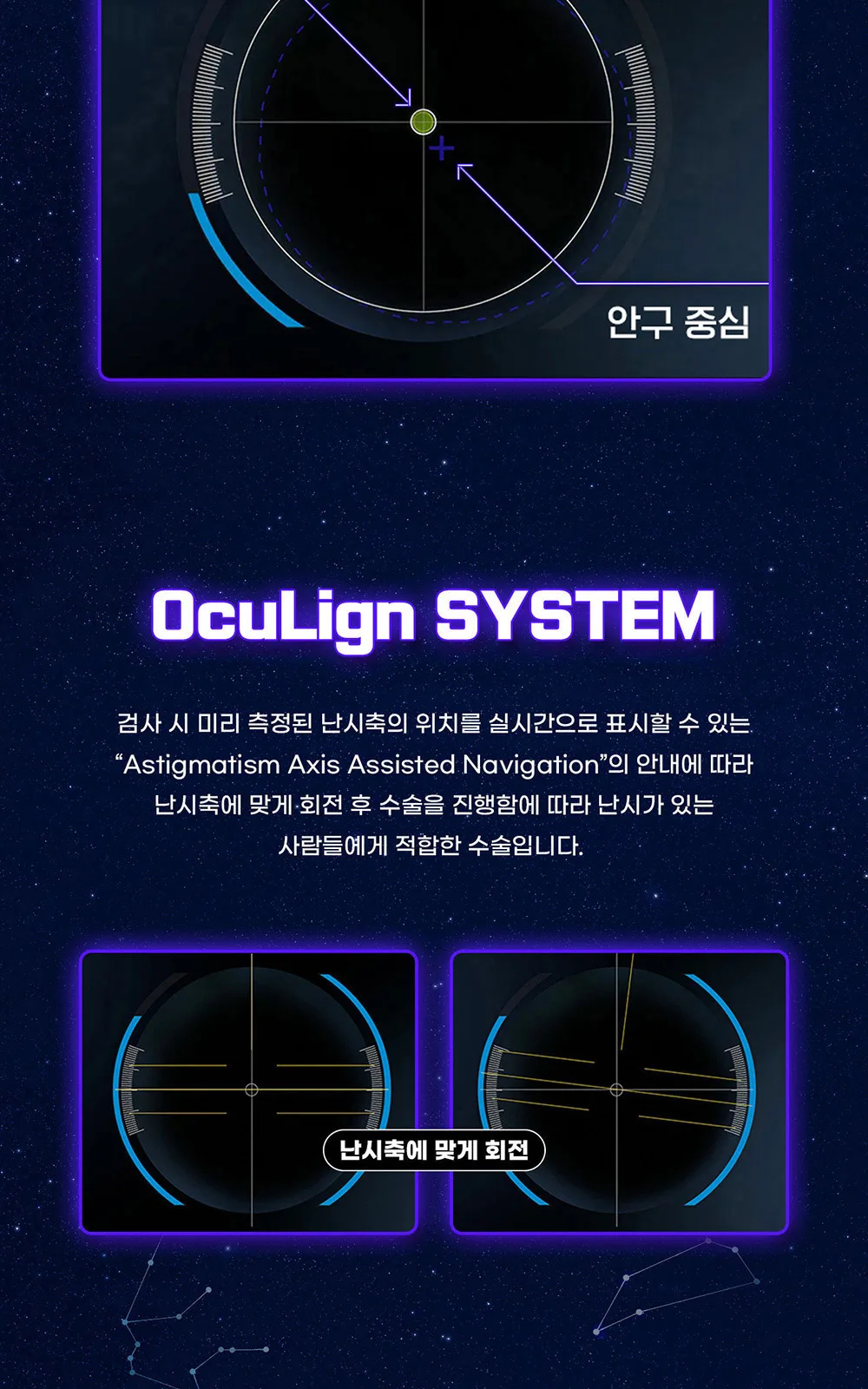 시술 상세 4