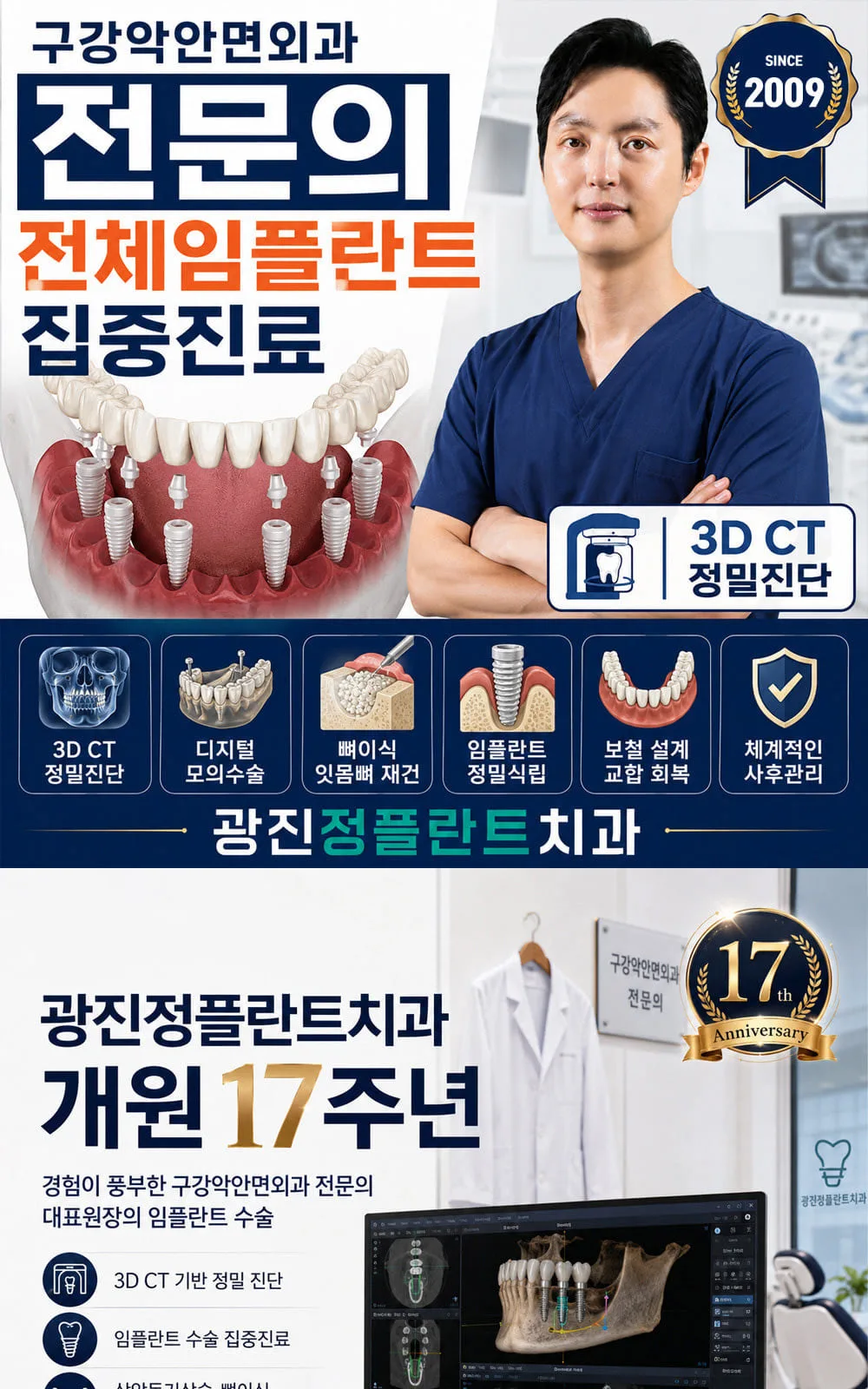 시술 상세 1