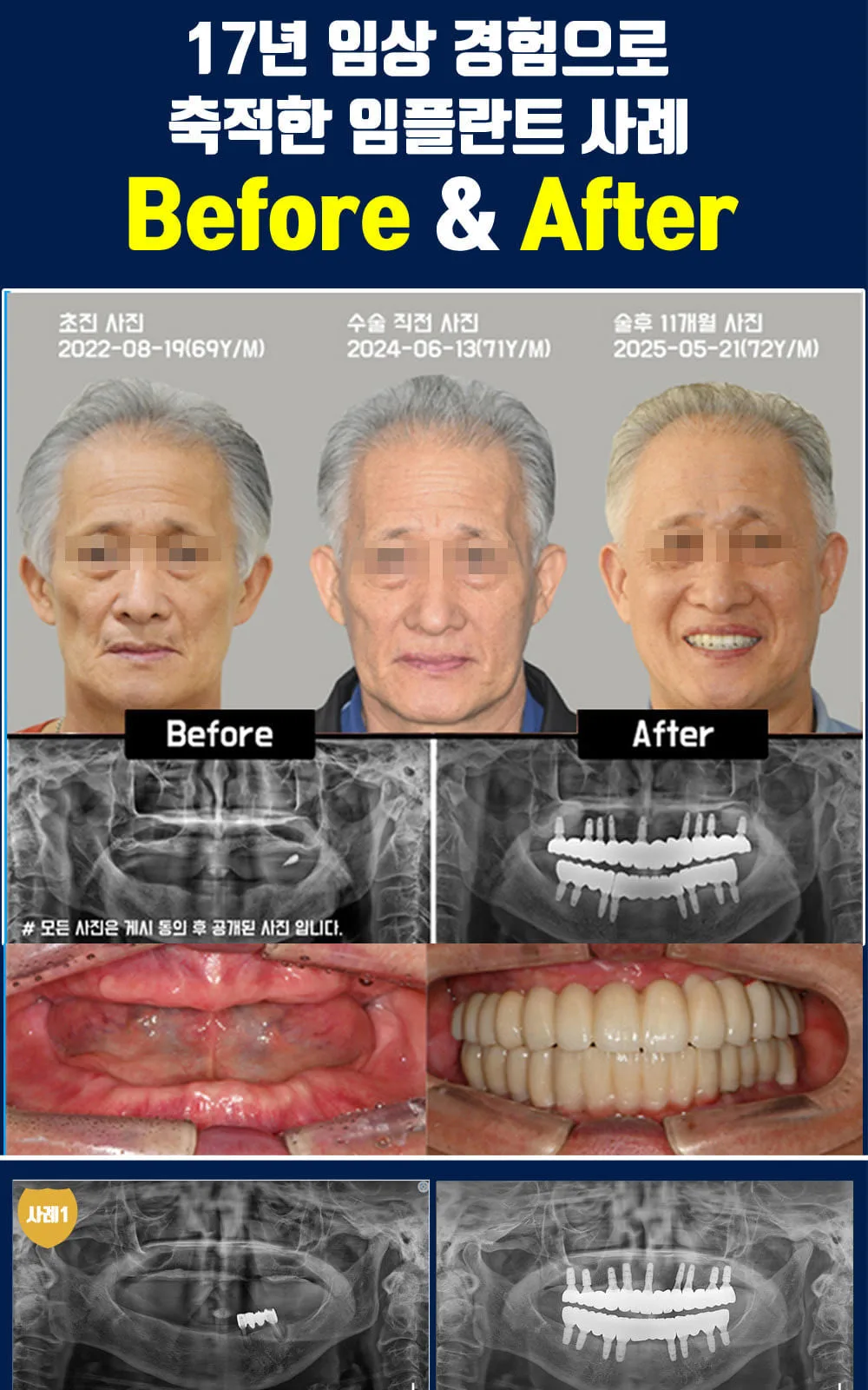 시술 상세 4