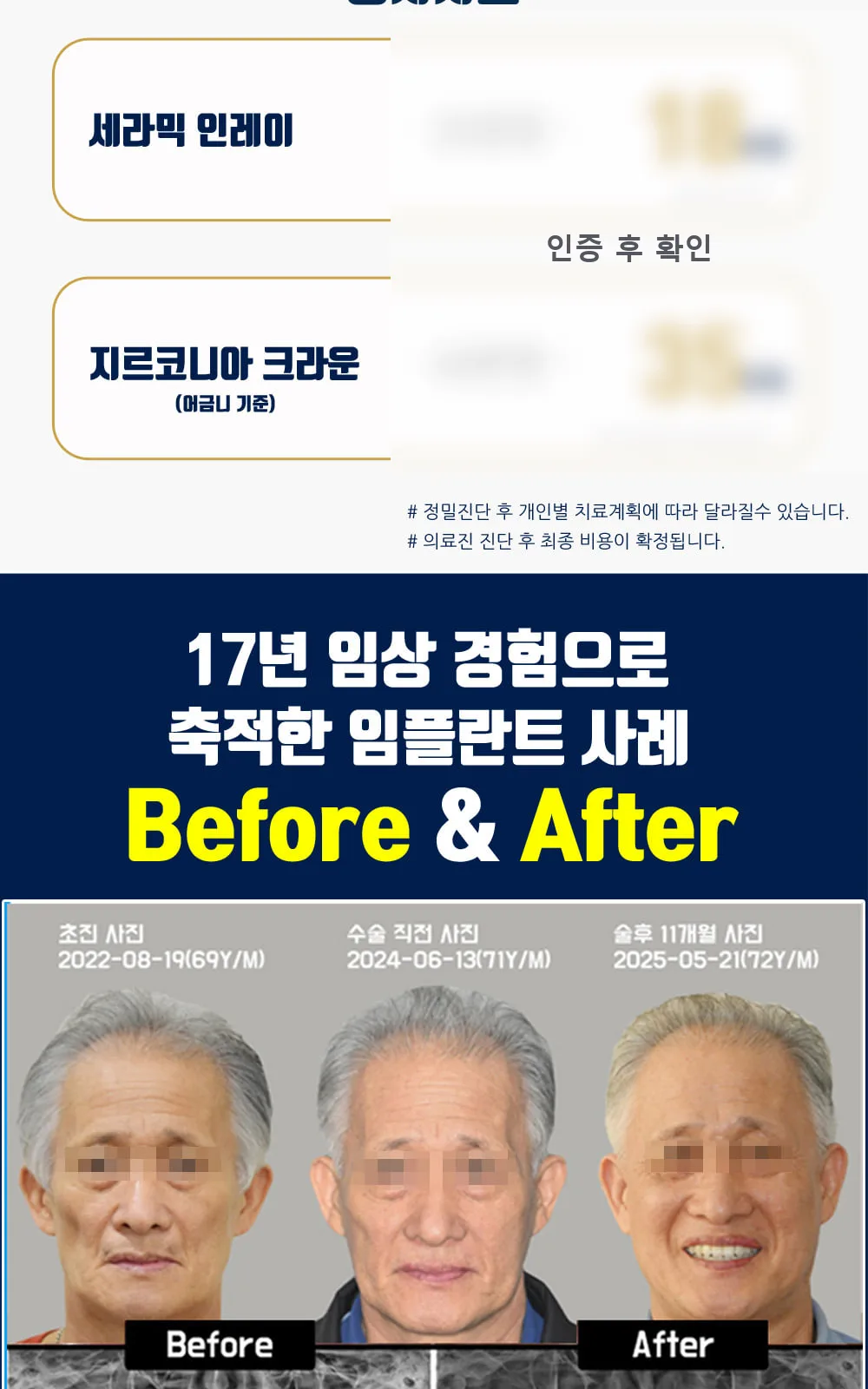 시술 상세 4