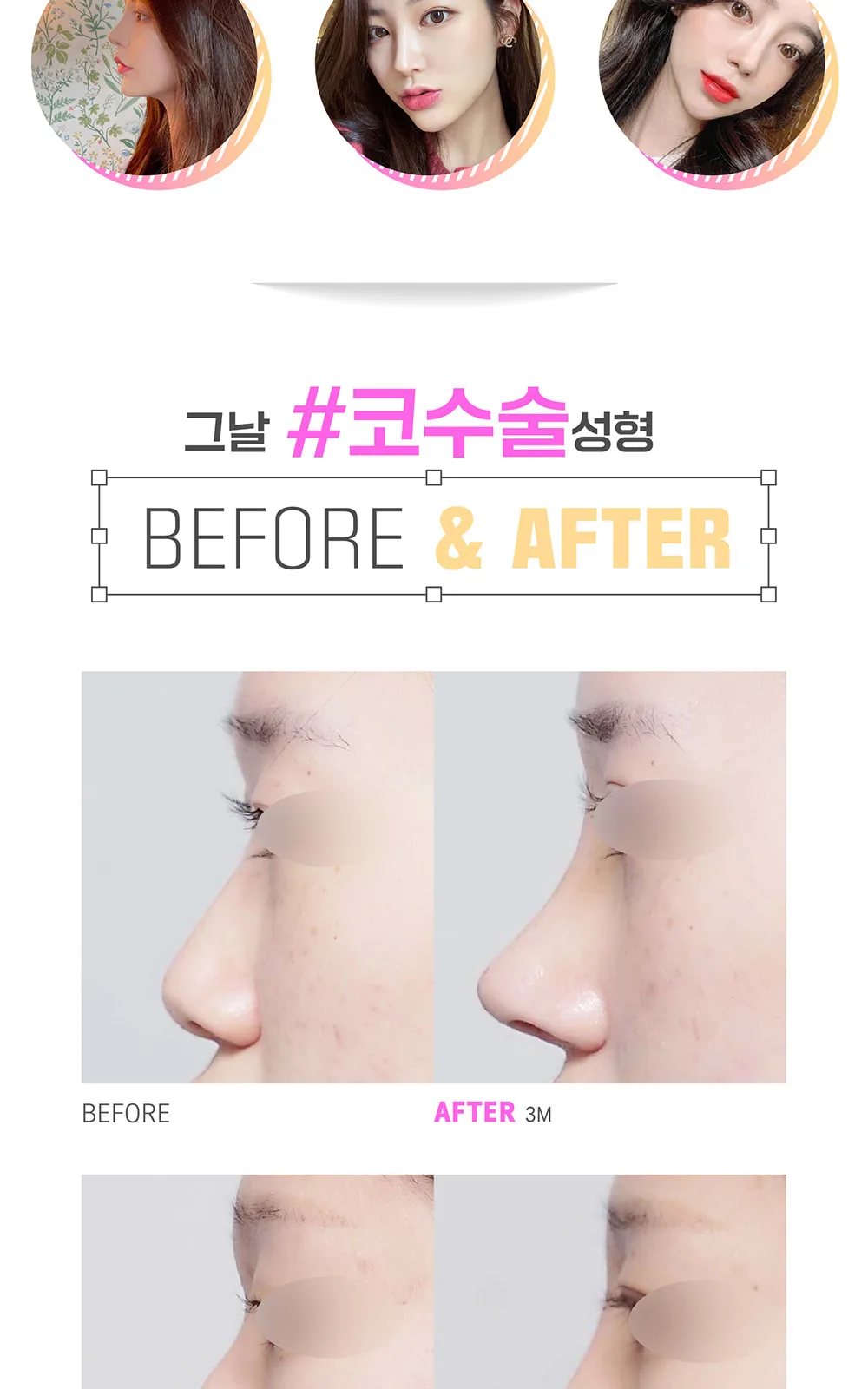 시술 상세 8