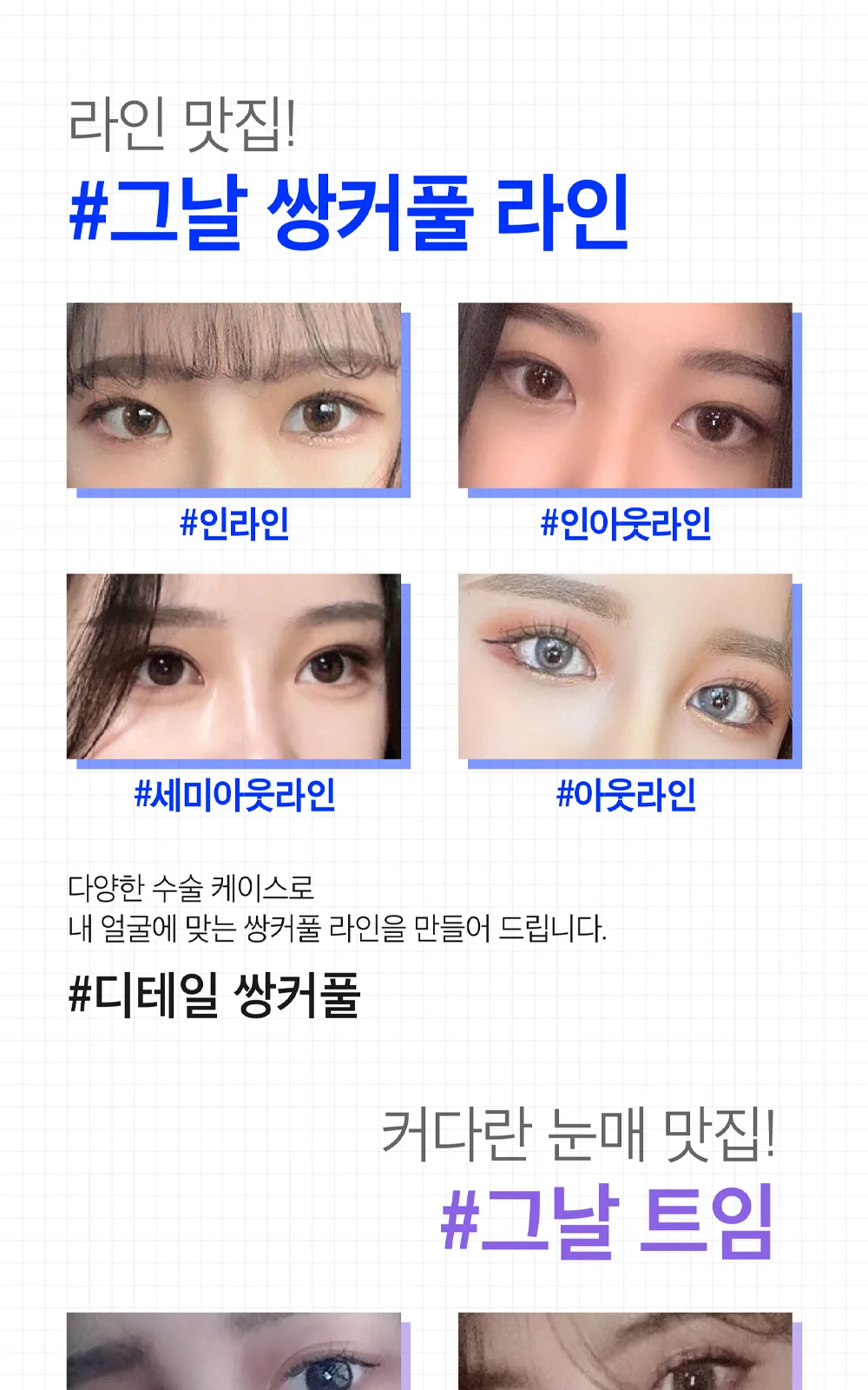 시술 상세 3