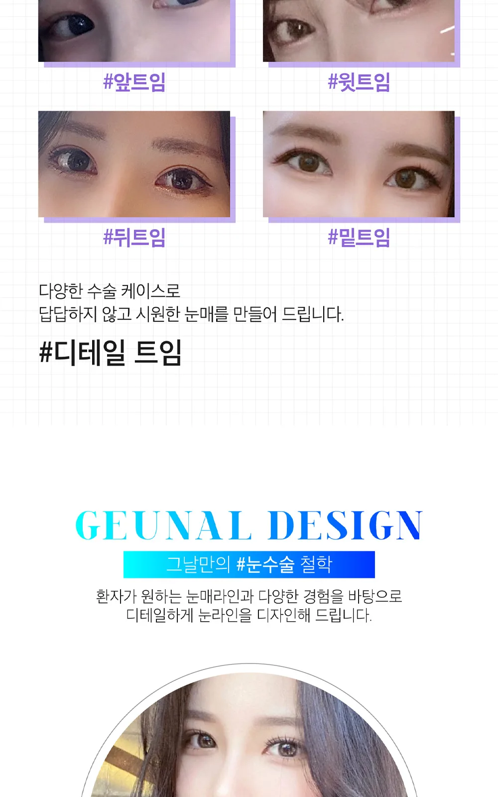 시술 상세 4
