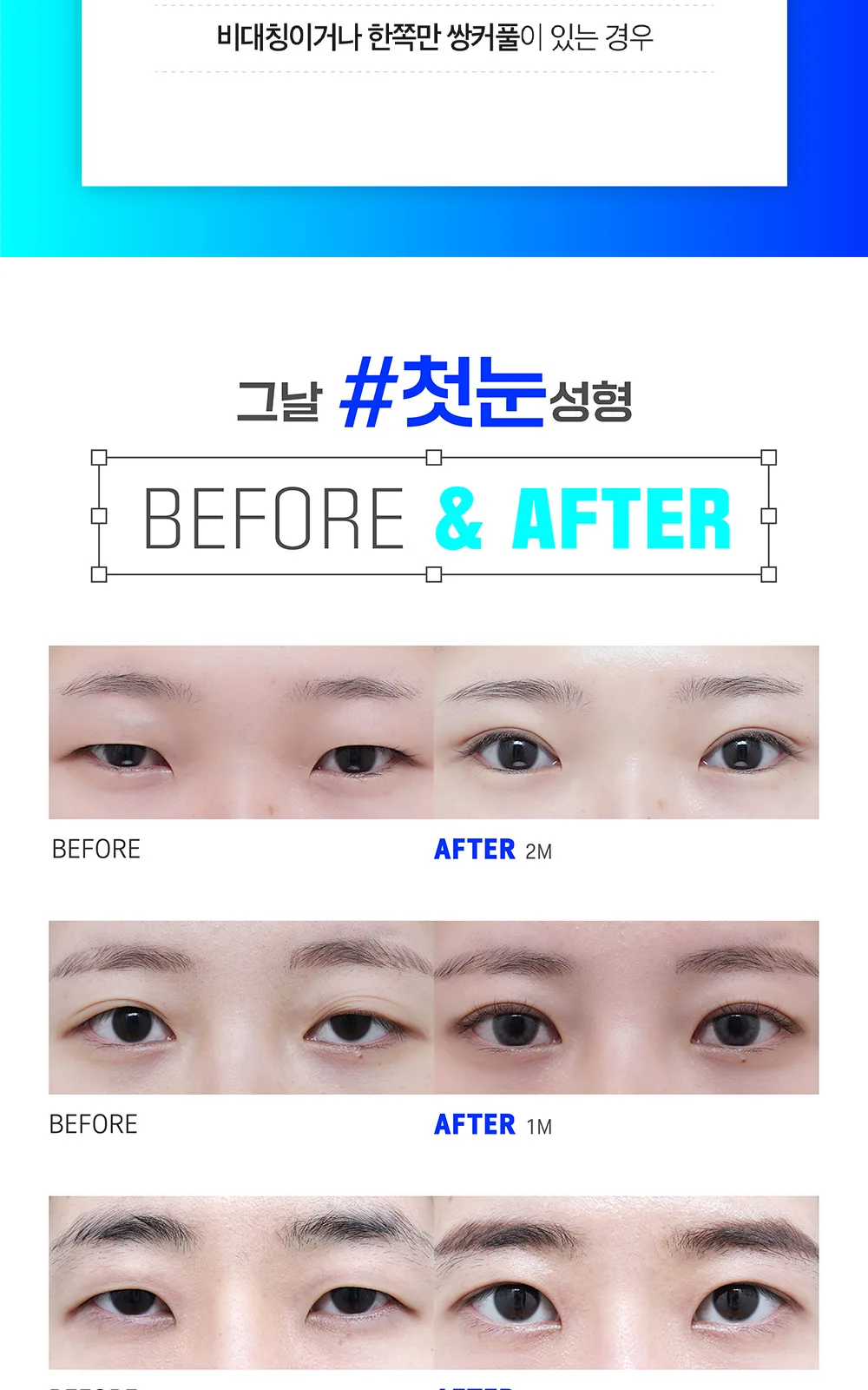 시술 상세 7