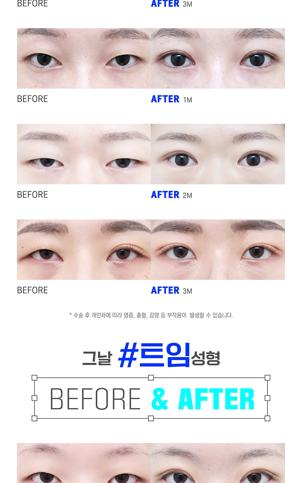 시술 상세 8
