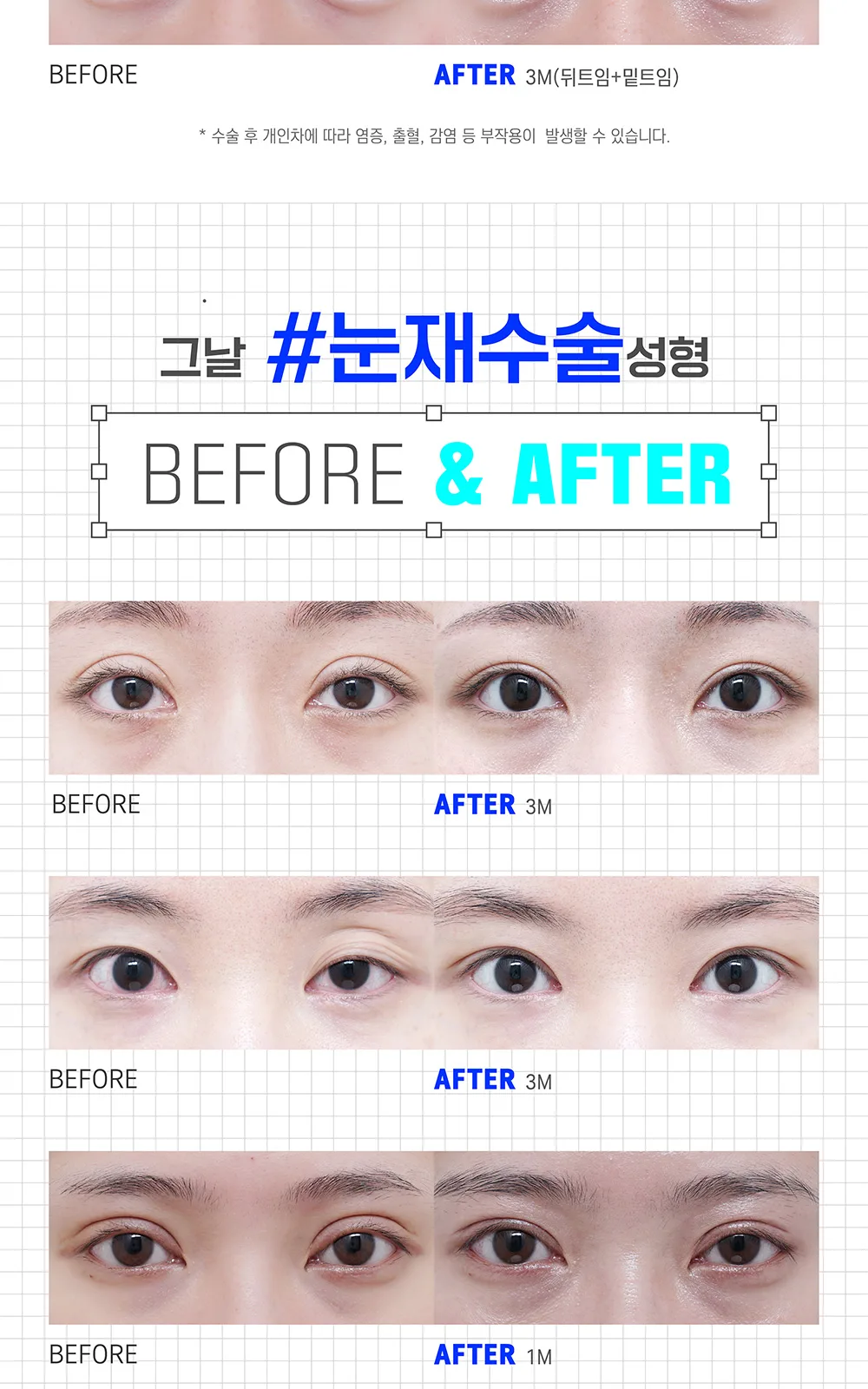 시술 상세 10