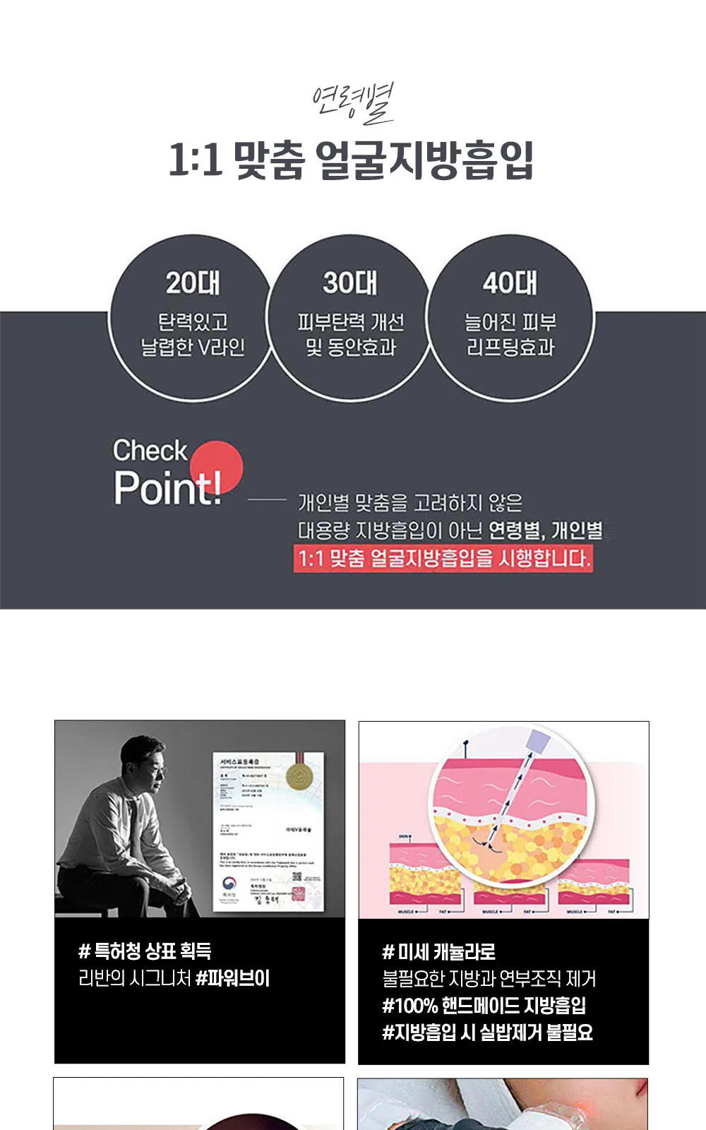 시술 상세 6