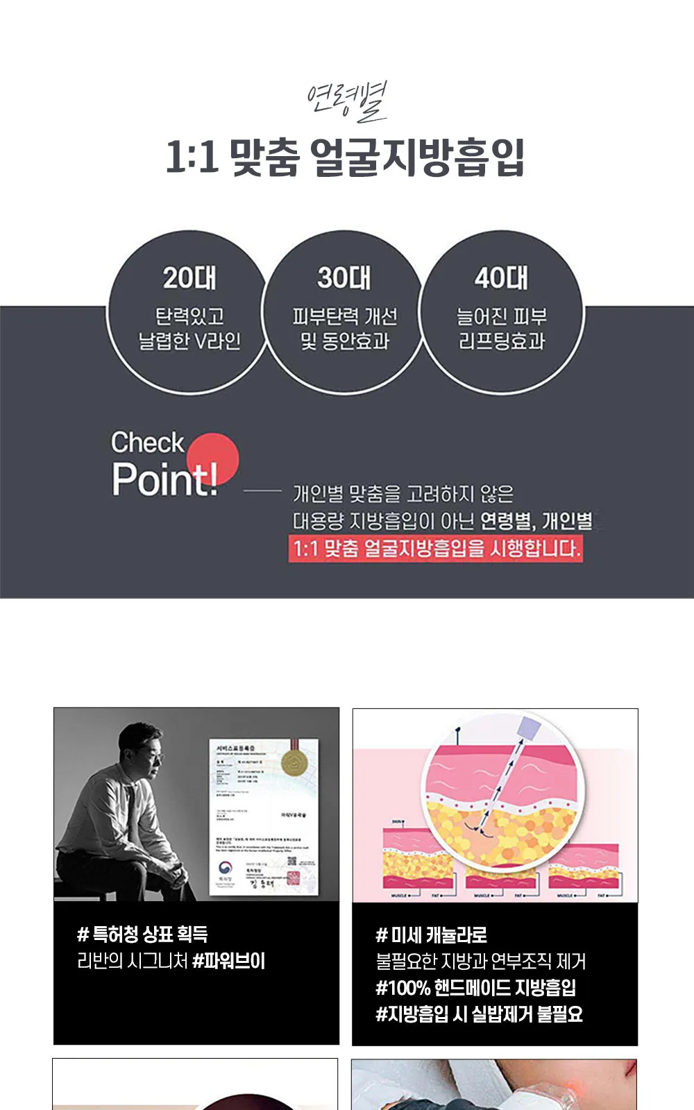 시술 상세 17