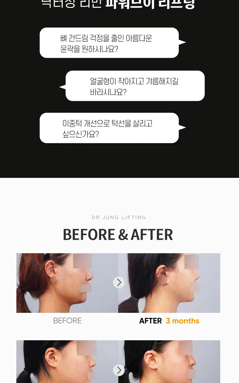 시술 상세 6