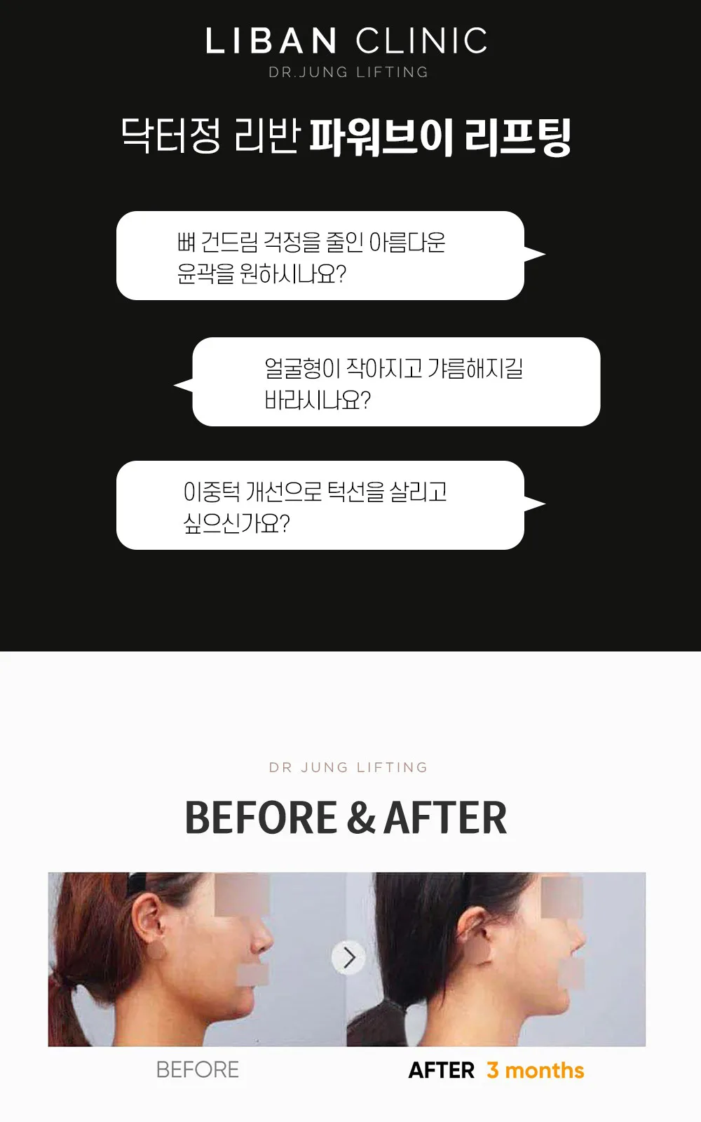 시술 상세 8