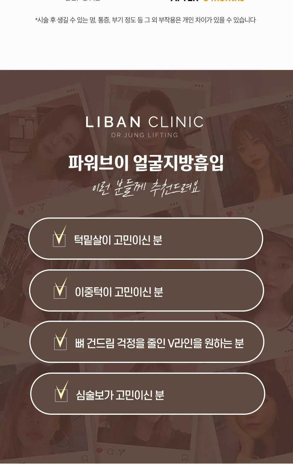 시술 상세 11