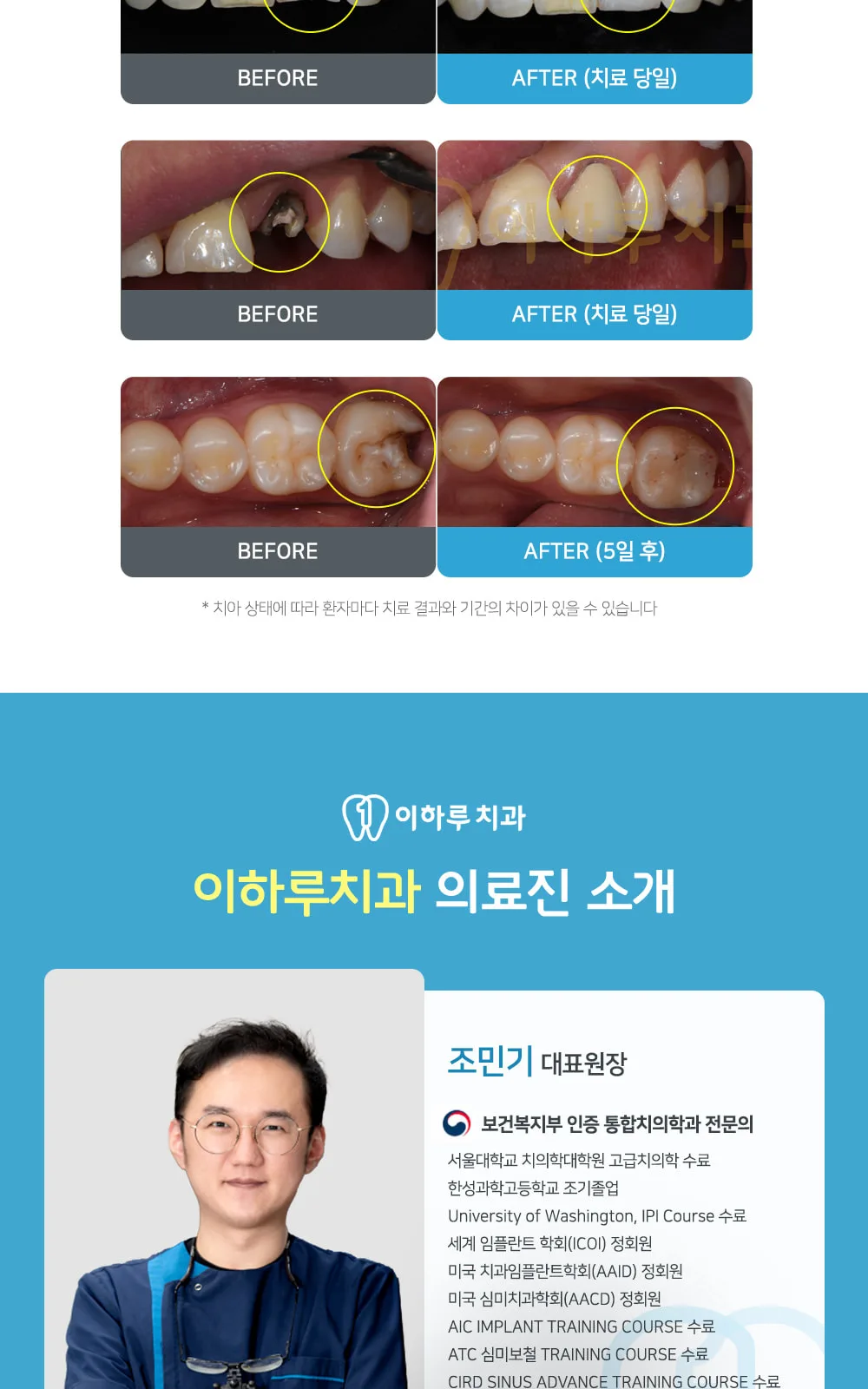 시술 상세 5
